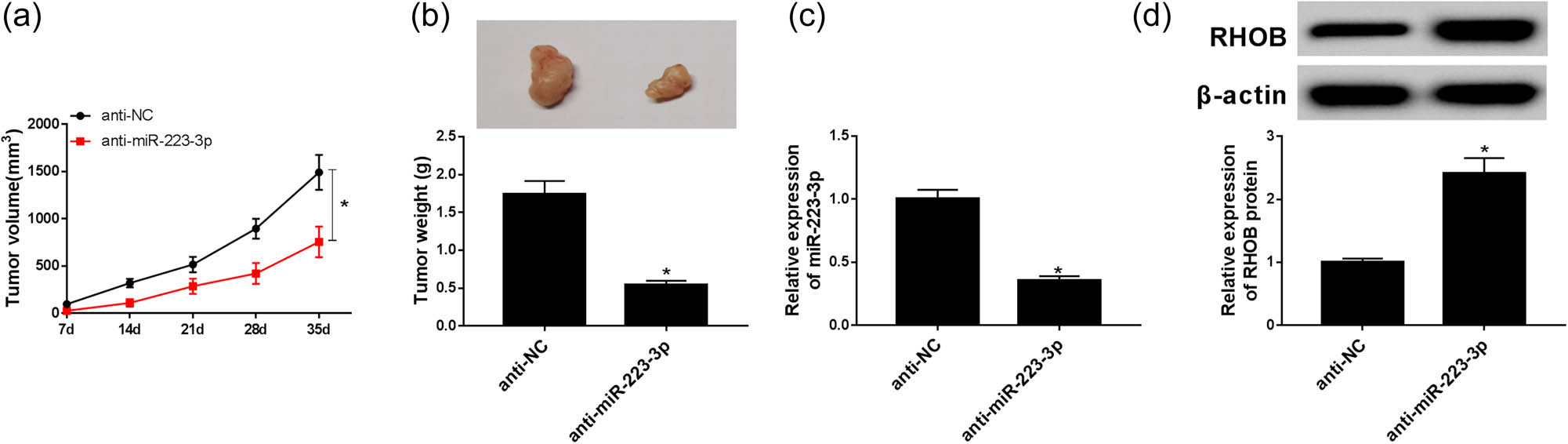 Figure 6 
                  NSCLC tumors were evaluated by tumor volume, weight, miR-223-3p expression, and RHOB protein expression. (a and b) Tumor volume and weight with anti-miR-223-3p or anti-NC were examined (n = 3). (c) RT-PCR was adopted to measure the miR-223-3p expression (n = 3). (d) RHOB protein expression was confirmed by western blot (n = 3). *P < 0.05.
               