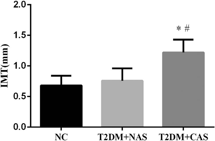 Figure 1 IMT of CA in healthy subjects, T2DM + NAS group, and T2DM + CAS group. The IMT of CA was examined by color Doppler ultrasonography. The IMT value of less than 1.0 mm was considered as normal. * indicates statistical significance (p < 0.05) compared to healthy subjects (NC); # indicates statistical significance (p < 0.05) compared to T2DM + NAS group.