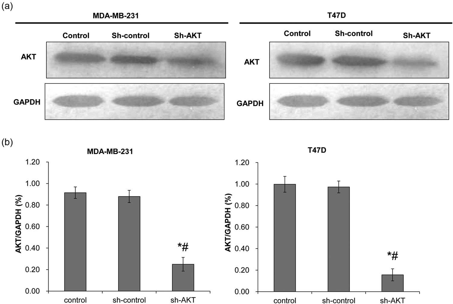 Figure 1 
                  Determination of lentiviral transfection efficiency. Western blot was used to detect AKT protein expression after shRNA transfection. The control group was not transfected with shRNA; the sh-control group was transfected with void vector; and the sh-AKT group was transfected with shRNA of AKT. (a) Representative Western blot results. (b) The quantified expression of AKT. Left: MDA-MB-231 cells; right: T47D cells. *P < 0.05, compared with the control group; #
                     P < 0.05, compared with the sh-control group.
               