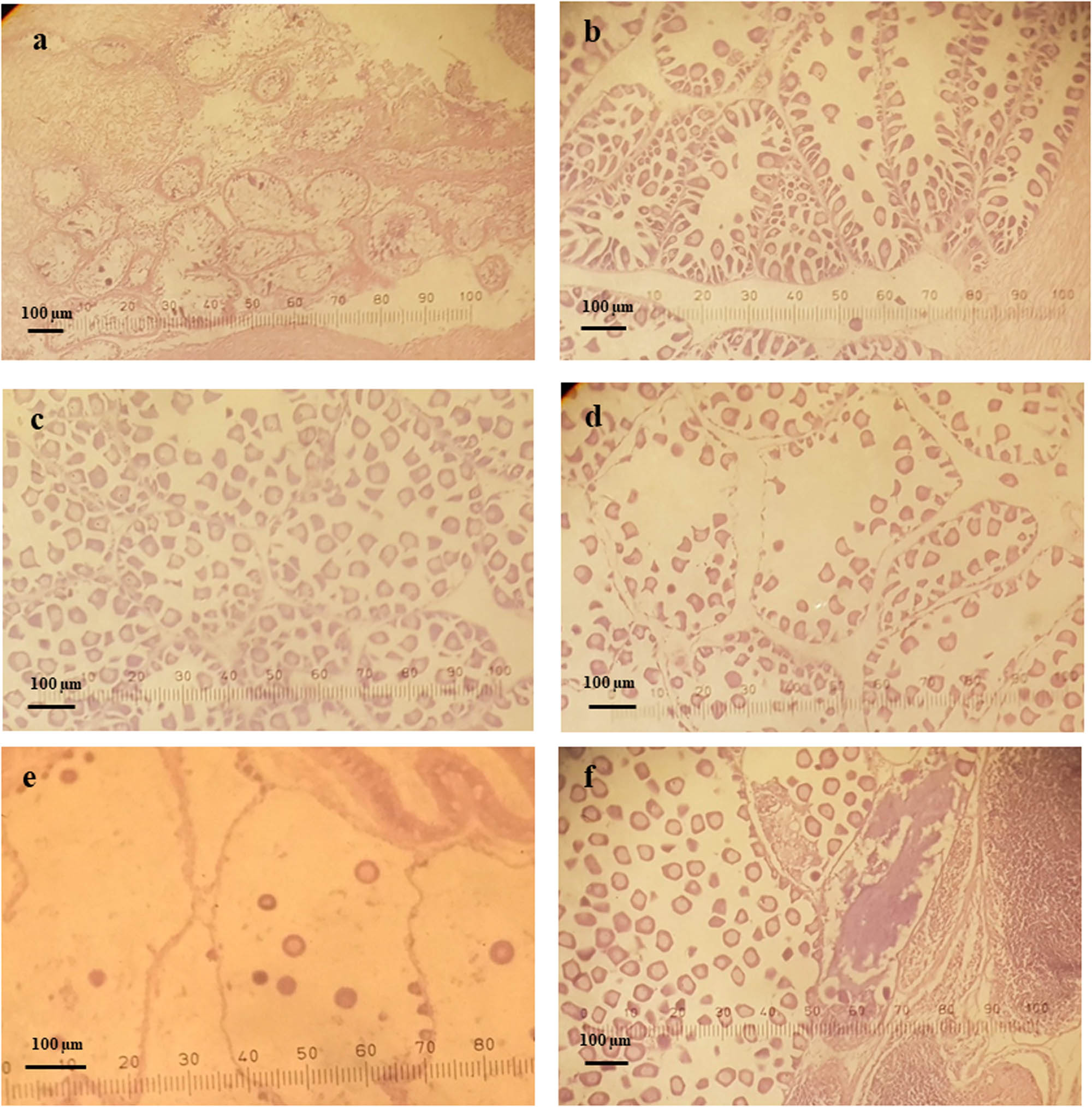 Figure 6 Microphotographs of gonadal development stages of female L. rhynchaena: (a) indifferent, (b) developing, (c) ripe, (d) spawning, (e) spent and (f) hermaphrodite.