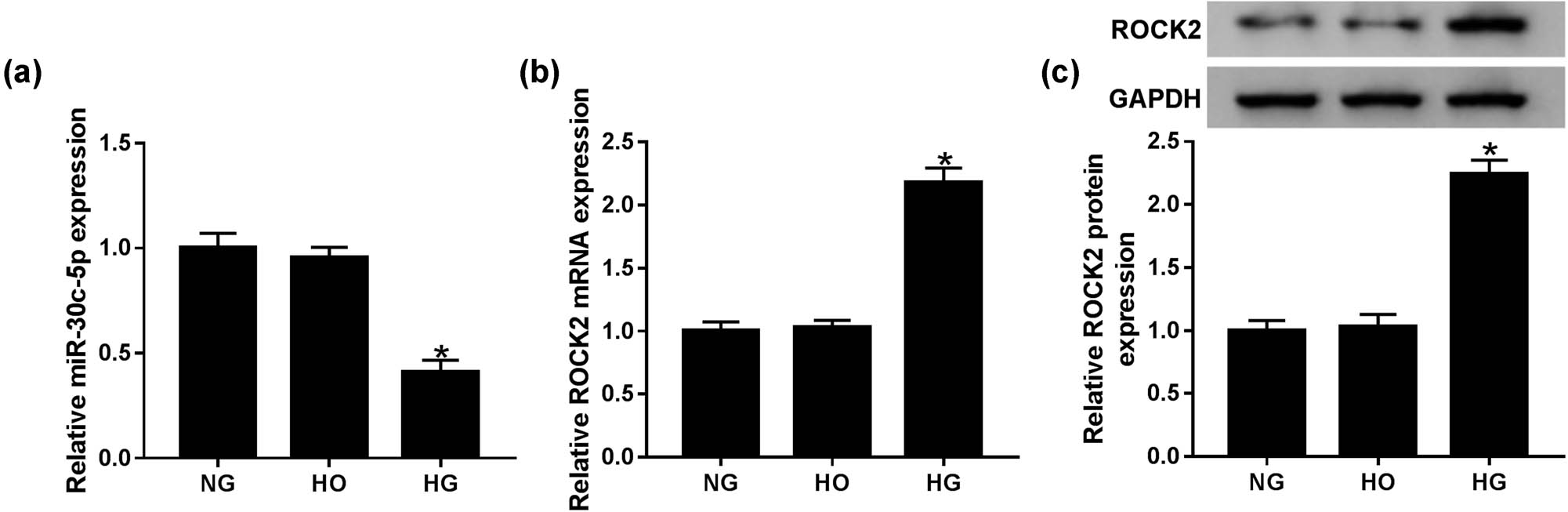 Figure 2 HG conditions in HK-2 cells induced ROCK2 expression but suppressed miR-30c-5p expression. (a and b) Levels of miR-30c-5p and ROCK2 were detected by qRT-PCR in HG-induced HK-2 cells. (c) Western blot assay was conducted to determine mature ROCK2 expression in vitro. NG: normal glucose (5.6 mmol/L d-glucose); HG: high glucose (30 mmol/L d-glucose); HO: high osmotic pressure solution (5.6 mmol/L d-glucose + 24.4 mmol/L d-mannitol). *P < 0.05.