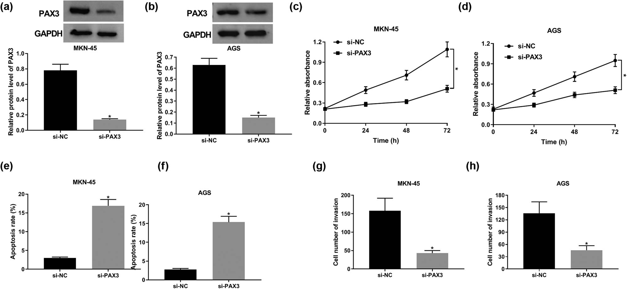 Figure 4
PAX3 knockdown repressed proliferation and invasion and induced apoptosis in GC. (a and b) The expression of PAX3 protein in MKN-45 (a) and AGS cells (b) transfected with si-PAX3 and si-NC. (c and d) Cell viability of MKN-45 (c) and AGS cells (d) transfected with si-PAX3 and si-NC for 24, 48, and 72 h. (e and f) The apoptotic rate of MKN-45 (e) and AGS cells (f) at 48 h post-transfection. (g and h) Cell invasion ability of MKN-45 (g) and AGS cells (h) at 48 h post-transfection. *P < 0.05.