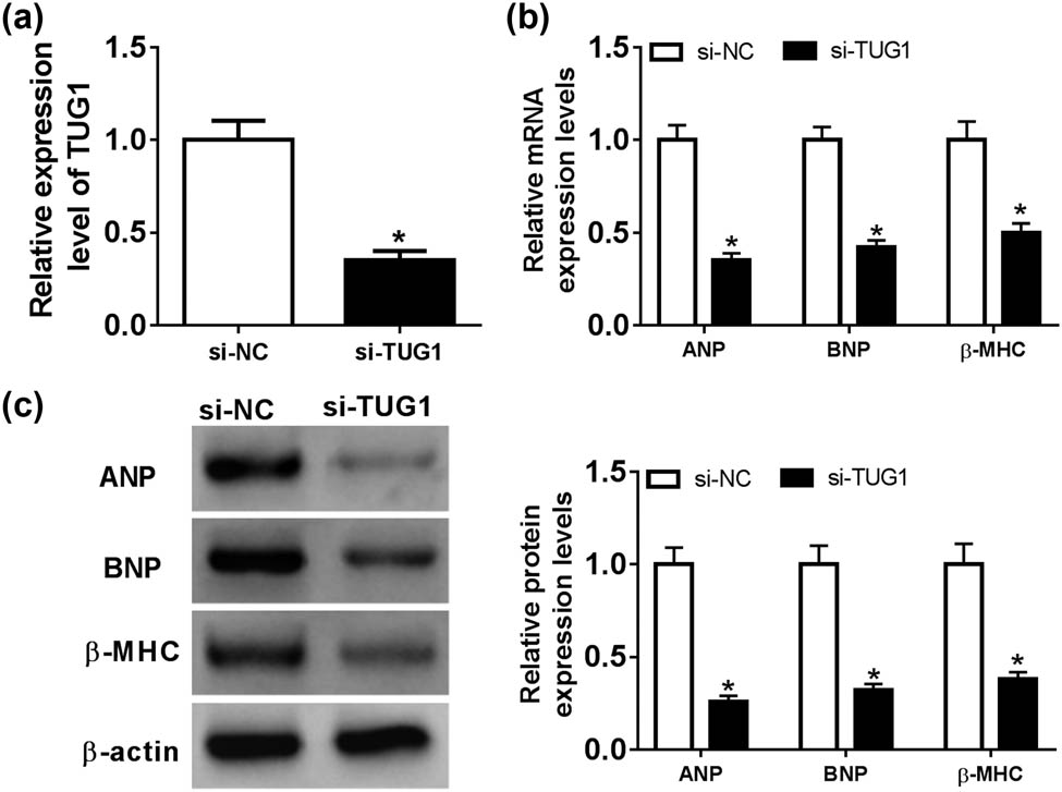 Figure 2 
                  TUG1 knockdown attenuated Ang II-induced cardiomyocyte hypertrophy. Cardiomyocytes were transfected with si-NC or si-TUG1 for 24 h and then treated with 1 mM of Ang II for 48 h, followed by the determination of TUG1 expression by qRT-PCR (a), the mRNA levels of ANP, BNP and β-MHC by qRT-PCR (b) and their protein levels by western blot (c). *P < 0.05.
               