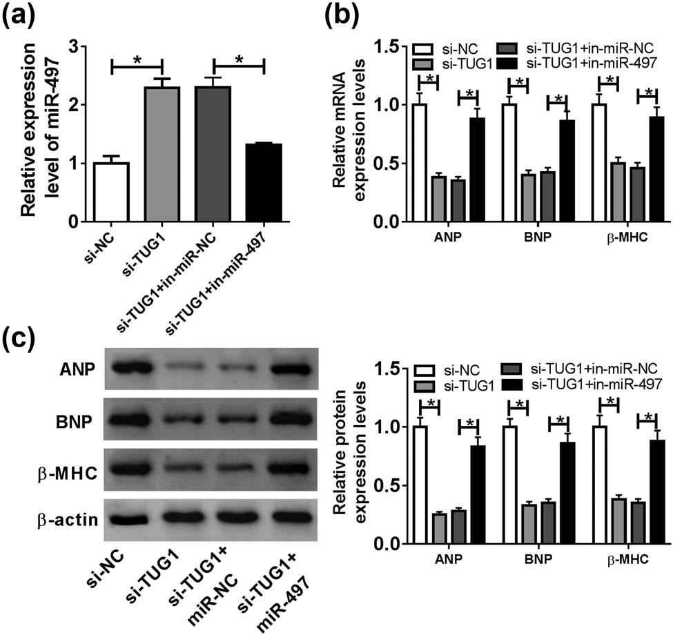 Figure 4 
                  miR-497 overexpression mediated the protective role of TUG1 knockdown in Ang II-induced cardiomyocyte hypertrophy. Cardiomyocytes were transfected with si-NC, si-TUG1, si-TUG1 + in-miR-NC or si-TUG1 + in-miR-497 before Ang II exposure, followed by the measurement of miR-497 expression by qRT-PCR (a), the mRNA levels of ANP, BNP and β-MHC by qRT-PCR (b) and their protein levels by western blot (c). *P < 0.05.
               