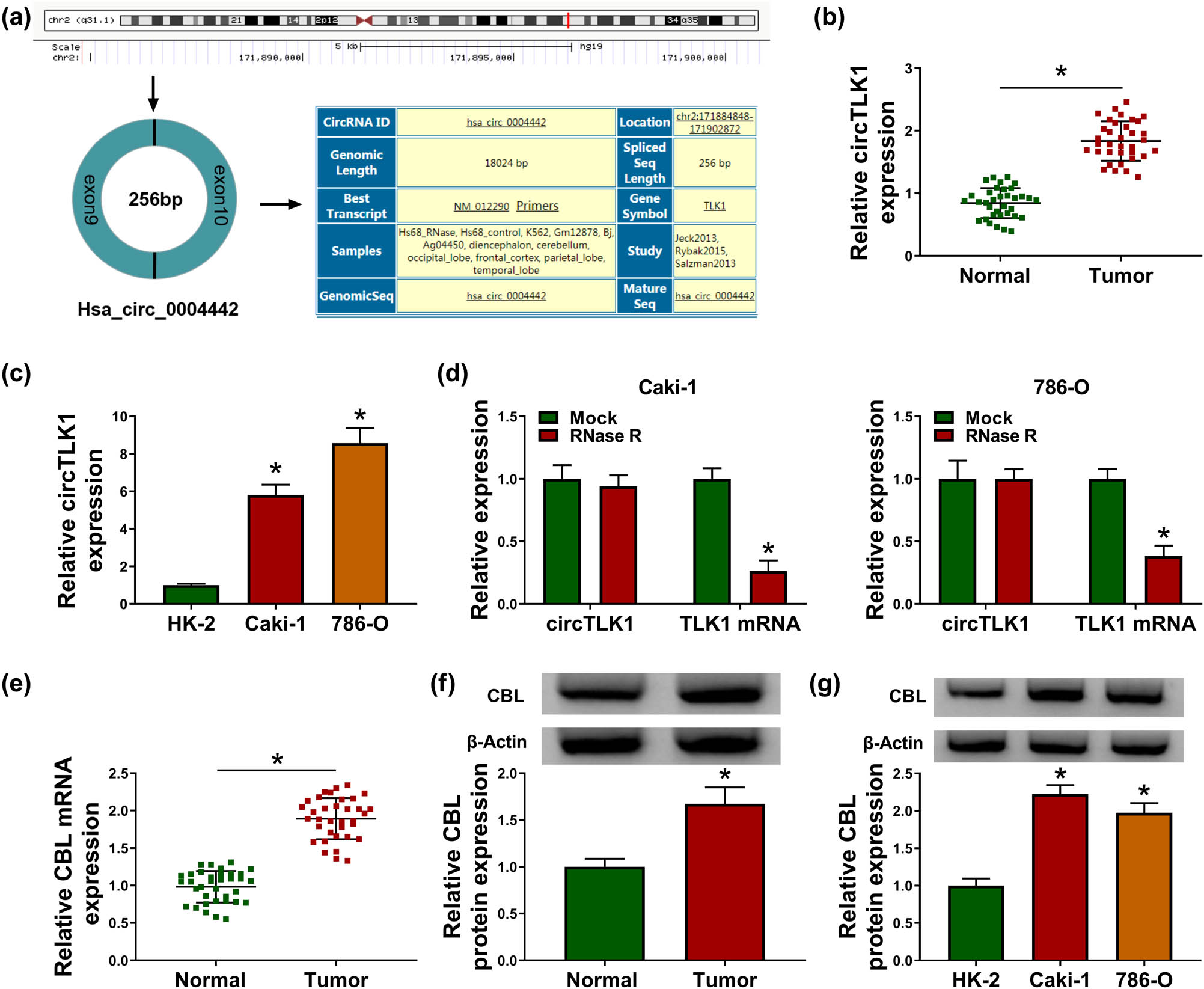 Figure 1
circTLK1 and CBL are up-regulated in RCC tissues and cells. (a) Schematic diagram showing the origin and formation of circTLK1. (b) circTLK1 expression was detected in RCC tissues (n = 35) and adjacent normal tissues (n = 35) by qRT-PCR. (c) circTLK1 level was measured in HK-2 cells and RCC cells (Caki-1 and 786-O). (d) After RNase R stimulation, the levels of circTLK1 and TLK1 mRNA were examined using qRT-PCR. (e and f) The mRNA and protein levels of CBL in RCC tissues and normal tissues were detected by qRT-PCR and western blot. (g) CBL protein level was measured in HK-2, Caki-1 and 786-O cells. *P < 0.05.