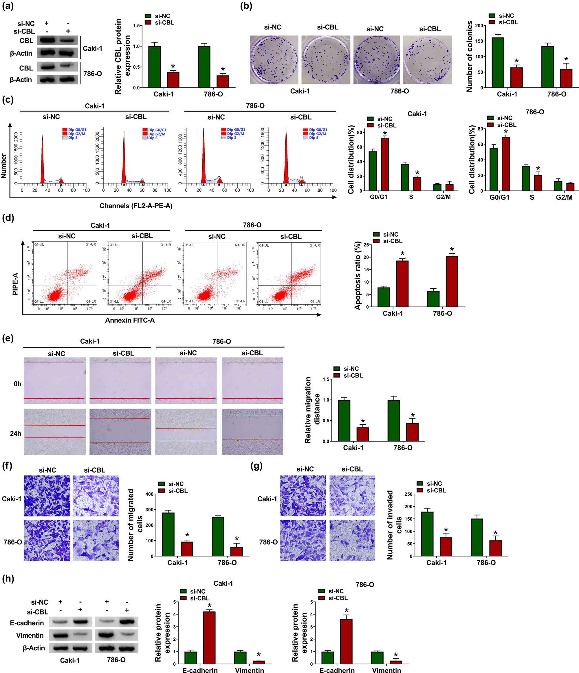 Figure 3
CBL silencing inhibits proliferation and metastasis and induces apoptosis in RCC cells. Caki-1 and 786-O cells were introduced with si-NC or si-CBL. (a) CBL protein level was measured by western blot. (b) Cell proliferation was assessed by colony formation assay. (c and d) Cell distribution and apoptosis ratio were determined by flow cytometry. (e–g) Cell migration and invasion were evaluated by scratch assay and transwell assay. (h) The protein levels of E-cadherin and Vimentin were examined by western blot. *P < 0.05.