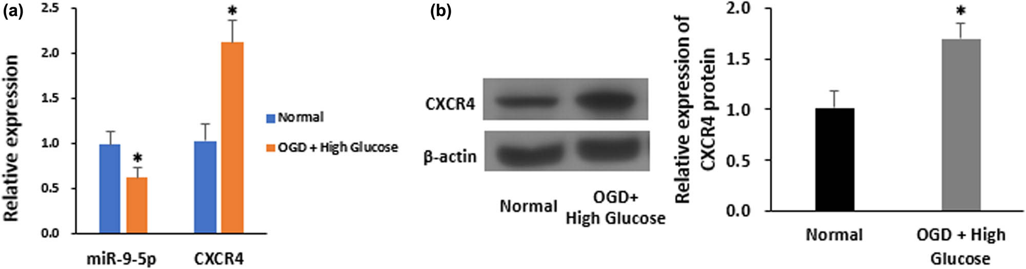 Figure 1 
                  OGD/HG damage alters expression levels of miR-9-5p and CXCR4 in cultured LSECs. (a) Expression levels of miR-9-5p and CXCR4 in LSECs after OGD followed by 12 h of HG treatment, as determined by quantitative RT-qPCR. (b) Immunoblotting of CXCR4 in OGD/HG-treated LSECs (left) and quantification of CXCR4 levels (right, n = 3). *P < 0.05 versus control. The data represent the mean ± standard deviation.
               