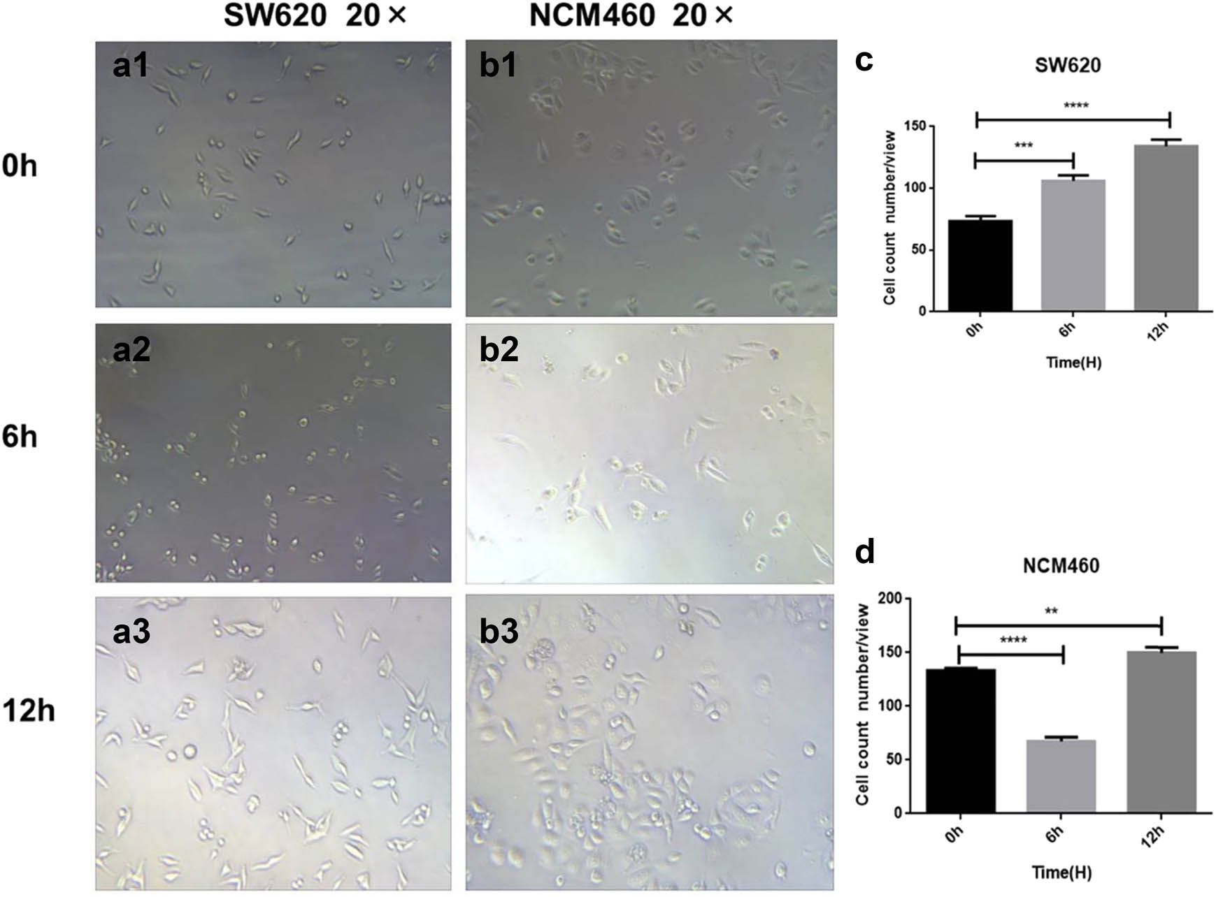 Figure 3
Images and statistical analysis of SW620 and NCM460 (b1–b3) cells stimulated by rBFT-1 for different time; (a1–a3 and c) SW620. (b1–b3 and d). NCM460. ns, *, **, and *** represent P > 0.05, P < 0.05, P < 0.01, and P < 0.001, respectively.