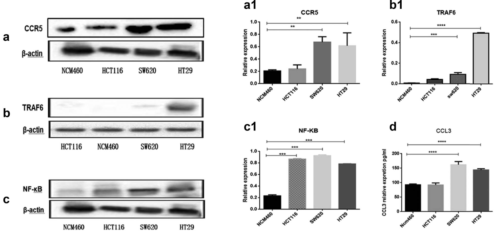 Figure 6
Expression of CCL3, CCR5, NF-κB, and TRAF6 in colorectal and CRC cells was measured by ELISA and Western blots. (a, a1; b, b1; c, c1) Representative immunoblots of CCR5, TRAF6, and NF-κB proteins in three human colon cancer cell lines (HCT116, SW620, HT29) and one normal colonic epithelial cell line (NCM460) (top panel), and the relative levels of these proteins (bottom panel). β-Actin was used as an internal control. (d) The expression of CCL3 protein was determined by ELISA. ns, *, **, and *** represent P > 0.05, P < 0.05, P < 0.01, and P < 0.001, respectively.