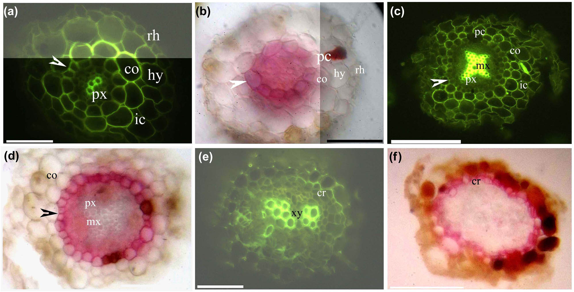 Figure 2 
                  Photomicrographs of Myricaria laxiflora fine adventitious roots (30–50 mm long); scale bars = 50 µm. (a) Protoxylem, endodermis (arrowhead), lignified cortex, intercellular space, hypodermis, and rhizodermis. Staining: BAB. (b) Endodermis (arrowhead), passage cells, cortex, hypodermis, and rhizodermis. Staining: SR7B. (c) Protoxylem, metaxylem, endodermis (arrowhead), passage cells, lignified cortex, intercellular space. Staining: BAB. (d) Protoxylem, metaxylem, endodermis (arrowhead), cortex. Staining: SR7B. (e) Primary xylem, cork. Staining: BAB. (f) Cork. Staining: SR7B.
               