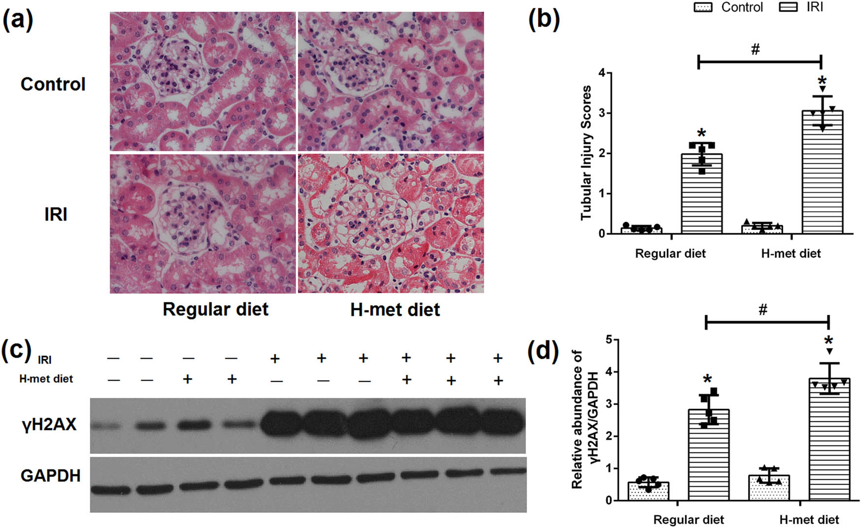 Figure 3 
                  HHcy exacerbates IRI-induced tubular injury and DNA damage. (a) Representative figures of H&E staining show the tubular injury at 24 h after reperfusion. (b) Quantification assessment of tubular injury on the basis of H&E staining. (c) Representative western blot figures of γH2AX. (d) Graphic representation of relative expression of γH2AX normalized to GADPH. Data are expressed as mean ± SD, n = 5. *P < 0.05 vs the control group under same diet. #
                     P < 0.05 vs the IRI group pretreated with regular diet. H-met diet: High methionine diet.
               