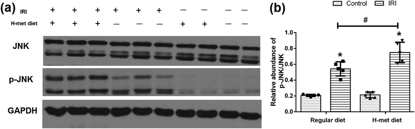Figure 4 
                  HHcy promotes IRI-induced JNK pathway activation. (a) Representative western blot figures of JNK and p-JNK. (b) Graphic representation of the ratio of p-JNK/JNK. Data are expressed as mean ± SD, n = 5. *P < 0.05 vs the control group under same diet. #
                     P < 0.05 vs the IRI group pretreated with regular diet. H-met diet: High methionine diet.
               