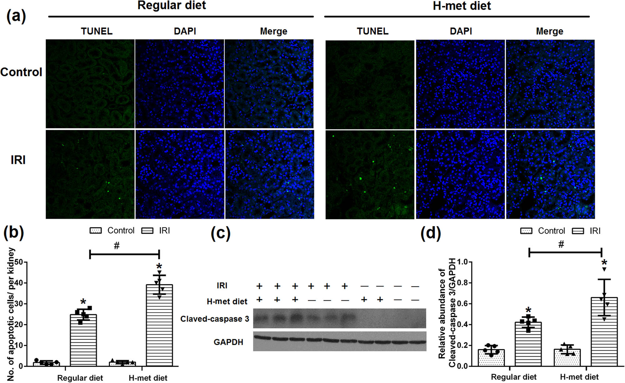 Figure 5 
                  HHcy exacerbates IRI-induced renal tubular epithelial cell apoptosis. (a) Representative immunofluorescence figures show apoptotic cell death detected by TUNEL staining at 24 h after reperfusion. (b) Quantitative determination of apoptotic tubular cells. The number of apoptotic cells was counted in 10 fields per section and five sections per kidney. (c) Representative western blot figures of cleaved caspase-3. (d) Graphic representation of cleaved caspase-3 normalized to GADPH. Data are expressed as the mean ± SD, n = 5. *P < 0.05 vs the control group under same diet. #
                     P < 0.05 vs the IRI group pretreated with regular diet. H-met diet: High methionine diet.
               