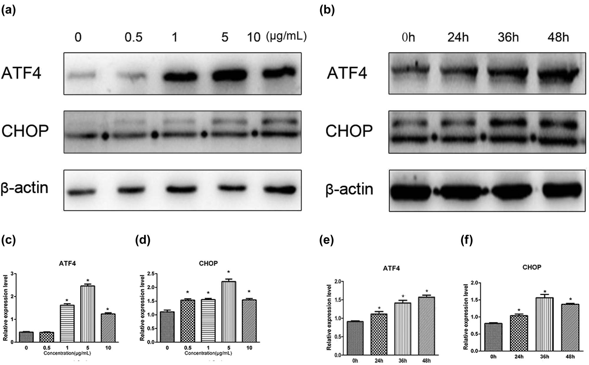 Figure 3
Effects of tunicamycin on the expression of ATF4 and CHOP in HEI-OC1 cells. (a) Example of western blots of ATF4 and CHOP protein expression in HEI-OC1 cells treated with various concentrations of tunicamycin (0–10 µg/mL) for 36 h. The expression of ATF4 and CHOP proteins in HEI-OC1 cells gradually increased with increasing concentrations of tunicamycin. (b) Example of western blots of ATF4 and CHOP protein expression in HEI-OC1 cells cultured with 5 µg/mL of tunicamycin for various culture times (0–48 h). The expression of ATF4 and CHOP proteins in HEI-OC1 cells gradually increased in the presence of TM with longer culture times. The western blots were quantitatively analyzed (c–f). A dose-response on ATF4 and CHOP expression was observed across the concentration range of 0.5–5 µg/mL of tunicamycin (all p < 0.05, c and d). At a fixed dose of 5 µg/mL tunicamycin, increased ATF4 protein was expressed when the cells cultured longer (all p < 0.05, e). Similar time-dependent effects on protein expression were also observed for CHOP when the cells were cultured for 24–36 h in the presence of tunicamycin (all p < 0.05, f). All results are expressed as
X
¯
±
SD
\bar{X}\pm \text{SD}
, * indicates p < 0.05.