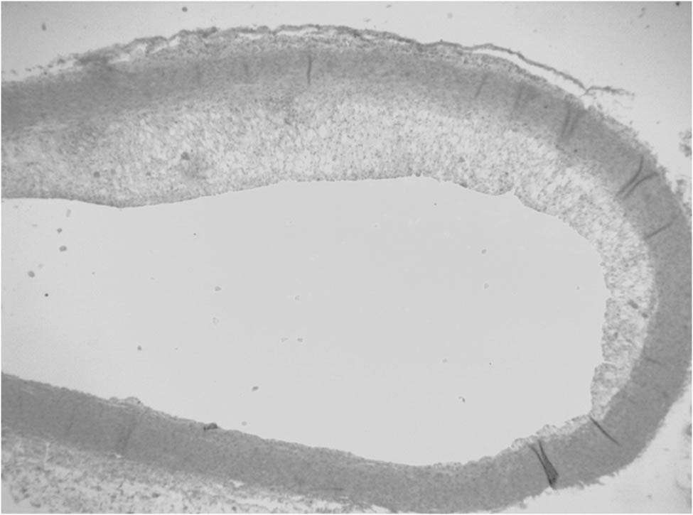 Figure 2 
                  Plaques from the control group were observed under a light microscope at the 8th week. The models were successfully established.
               