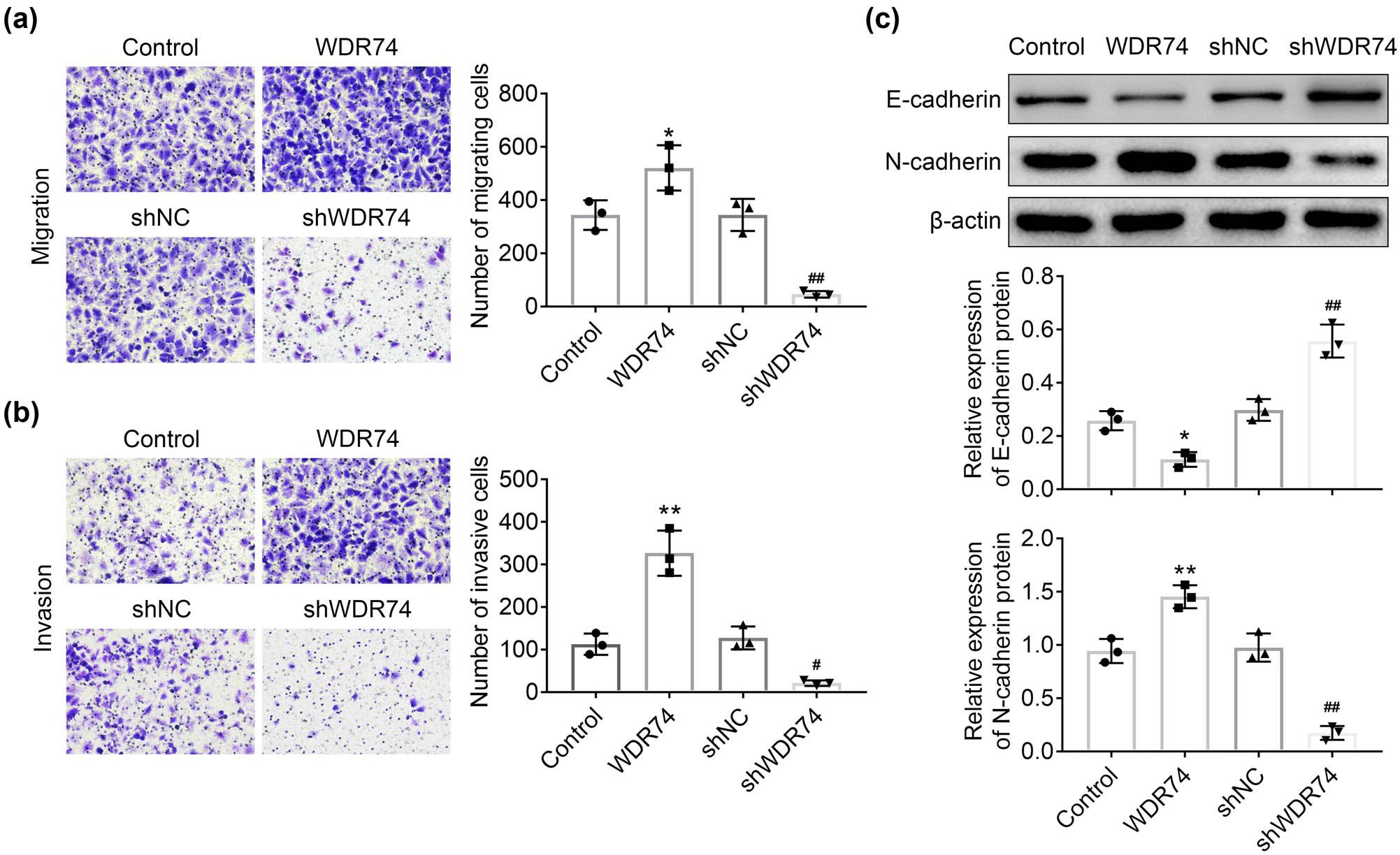 Figure 4 
                  WDR74 knockdown suppressed migration and invasion of CRC cells. (a) and (b) The transwell assay in HCT116 cells transfected with sh-NC, sh-WDR74, ov-NC, and ov- WDR74. C Protein levels of EMT markers determined by western-blot in HCT116 cells. *
                     p < 0.05, compared with control; **
                     p < 0.01, compared with control; ##
                     p < 0.01, compared with sh-NC. Results are presented as mean ± SD of three independent experiments.
               