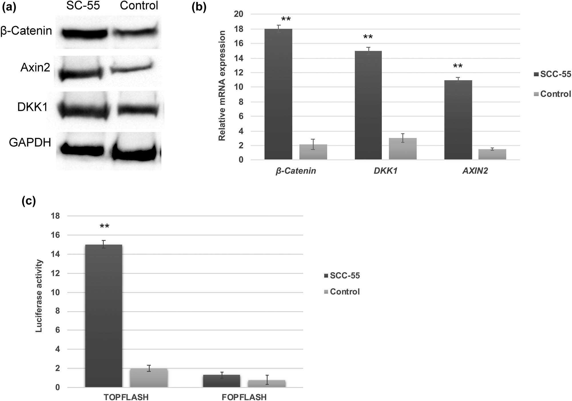 Figure 1 
                  Aberrant activation of Wnt/β-catenin signaling in OSCC. Western blot (a) and RT-PCR analysis (b) showing that Wnt/β-catenin and its downstream targets are activated and upregulated in OSCC SCC-55 cells. (c) TOPFLASH luciferase activity showing the elevated transcriptional level of Wnt/β-catenin in SCC-55 cells. The values in the error bar are± standard deviation (SD); ** p < 0.01.
               