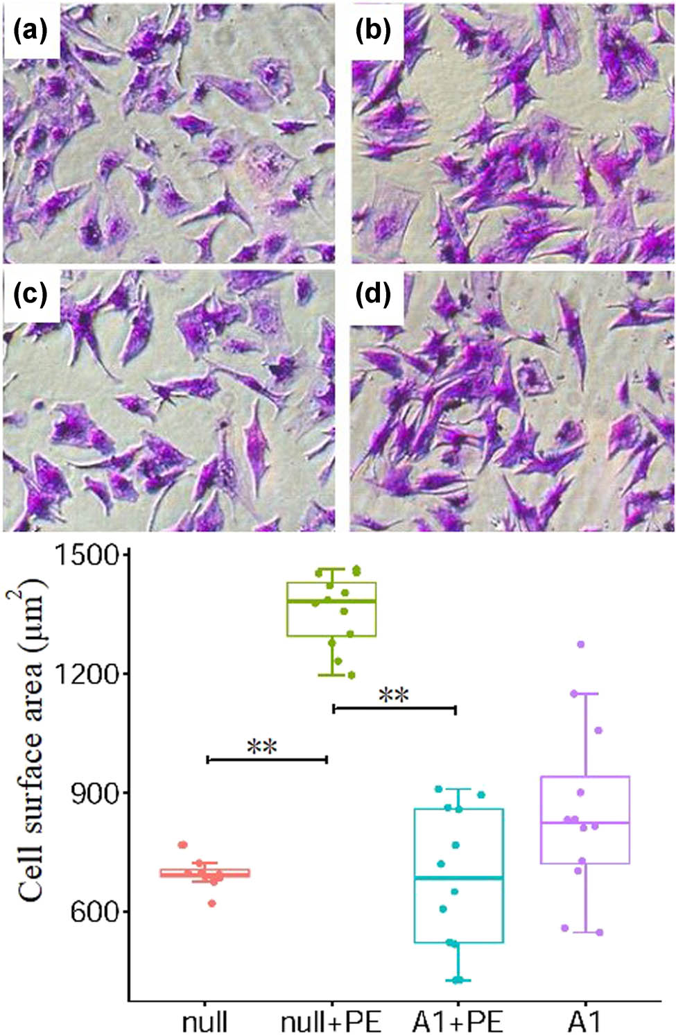 Figure 2 
                  PE stimulation promoted cell hypertrophy which was attenuated by pre-treatment with Ad-CnAβshRNA1. Color picture showed the ventricular cells stained with crystal violet in four groups. a, b, c, and d are the null, null + PE, A1 + PE, and A1 groups, respectively (×100). The histogram showed the comparative results of cell area in groups. *P < 0.05, **P < 0.01. PE: Phenylephrine. A1: Ad-CnAβshRNA.
               
