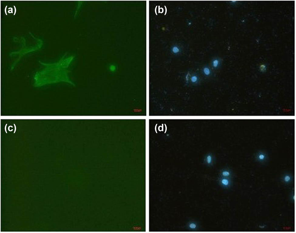 Figure A 
                  Identification of ventricular myocytes. After 48 h of culture, myocardial cells were demonstrated by immunofluorescent staining with α striated muscle sarcomere actin (α-SCA) antibody that is specialized to striated muscle. (a) Cells appearing green were identified as myocardial cells. (c) Staining for fibroblasts was negative. (b and d) The blue was nuclei stained with diamidine phenylindole. Panels (a) and (b), (c), and (d) are the same view, respectively (×200).
               