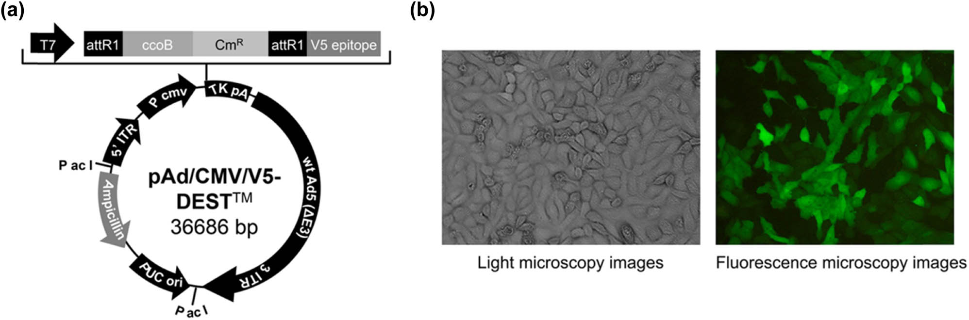 Figure A1 
                  Construction of adenovirus vector for AOC3 overexpression. (a) Adenoviral vector (pAD/CMV/V5-DEST) for AOC3 overexpression. (b) Light and fluorescence microscopic images confirmed the successful transfection of RIMECs with pAd-AOC3-IRES-EGFP (magnification, 200×).
               