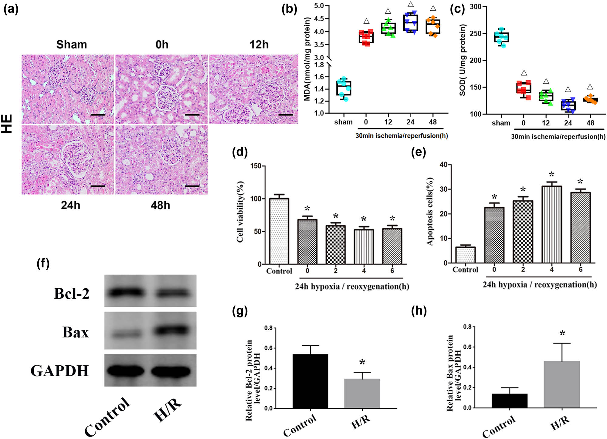 Figure 1 
                  IRI induces renal apoptosis. (a) HE staining of kidney tissues from the sham and IRI groups. Scale bar, 50 µm. (b and c): Levels of MDA and SOD in kidney tissue in the sham and IRI groups. (d) Quantitative analysis of cell proliferation levels. (e) Quantitative analysis of the percentage of apoptotic cells by flow cytometry. (f) Expression levels of apoptosis-related proteins (Bax and Bcl-2) in the control and H/R groups. (g and h) Quantitative values of the relative expression levels of the Bax and Bcl-2 proteins in the control and H/R groups. The data are expressed as the mean ± SD. ΔP < 0.05 versus the sham group, *P < 0.05 versus the control group.
               