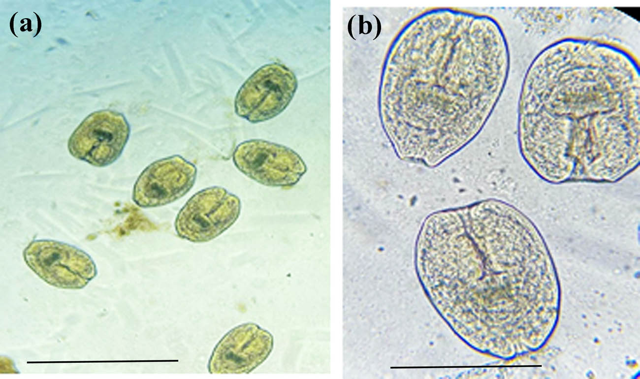 Figure 1 
                  
                     Echinococcus granulosus protoscolices at 10× (a), and 40× (b) magnifications. Scale-bars: 100 µm.
               