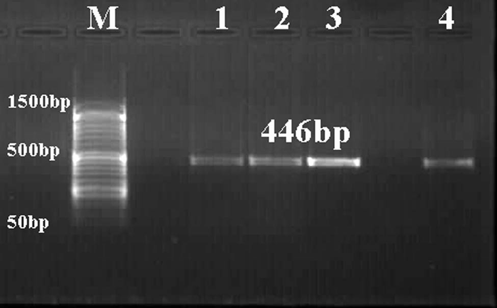 Figure 3 
                  Representative agarose gel stained with ethidium bromide (1.5%) showing PCR product (446 bp) of COX1 of E. granulosus (lanes 1 and 2) and T. multiceps (lanes 3 and 4) cysts. Lane M: low-molecular-weight marker (50–1,500 bp).
               