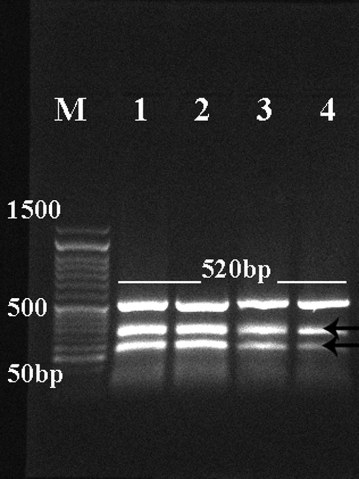 Figure 4 
                  Representative 1.5% agarose gel showing PCR product (main amplicon size 520 bp) of NAD1 of E. granulosus (lanes 1 and 2) and T. multiceps (lanes 3 and 4) cysts. Low bands are nonspecific bands. Lane M: low-molecular-weight marker (50–1,500 bp).
               