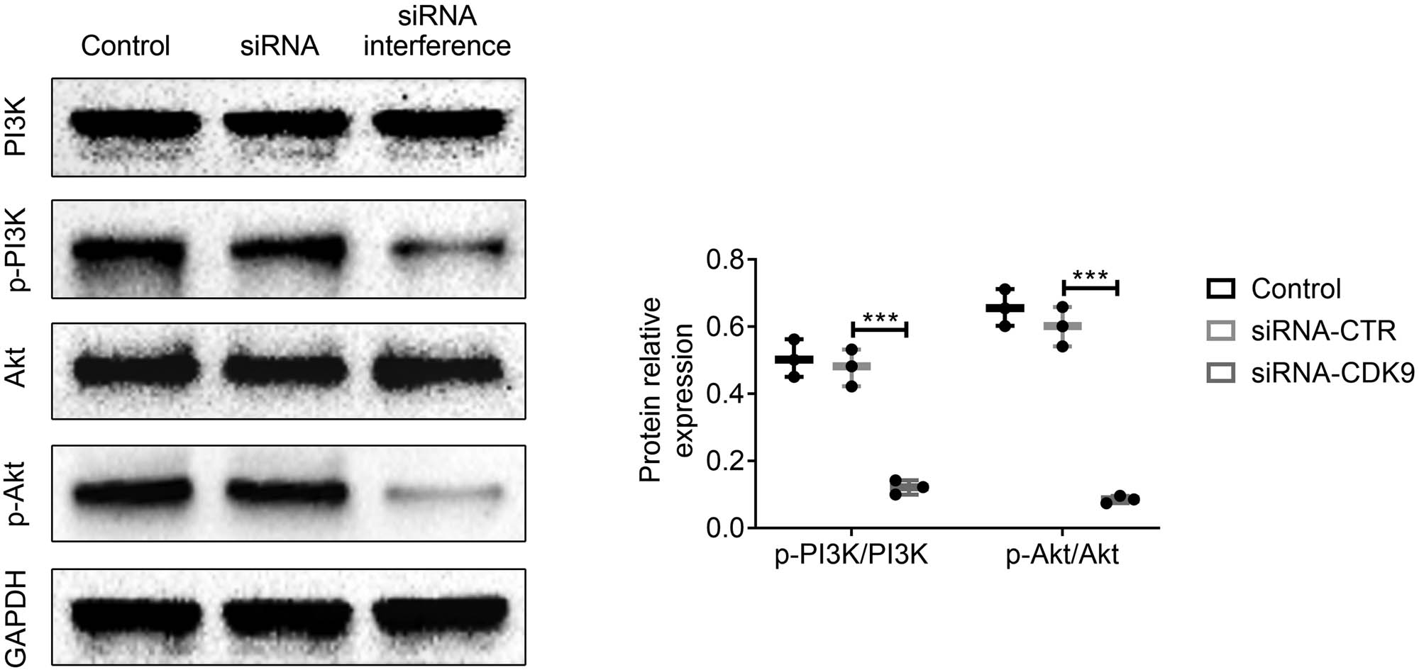 Figure 5 
                  Effects of CDK9 interference on PI3K/AKT signaling pathway in HEC-1B cells. (a) Western blot assay was used to analyze the protein expressions of GAPDH, CDK9, p-PI3K, PI3K, p-AKT, and AKT in HEC-1B cells. (b) The protein relative expression levels of p-PI3K/PI3K and p-AKT/AKT from (a). Data were expressed as mean ± SD. ***p < 0.001 represents a statistically significant difference.
               