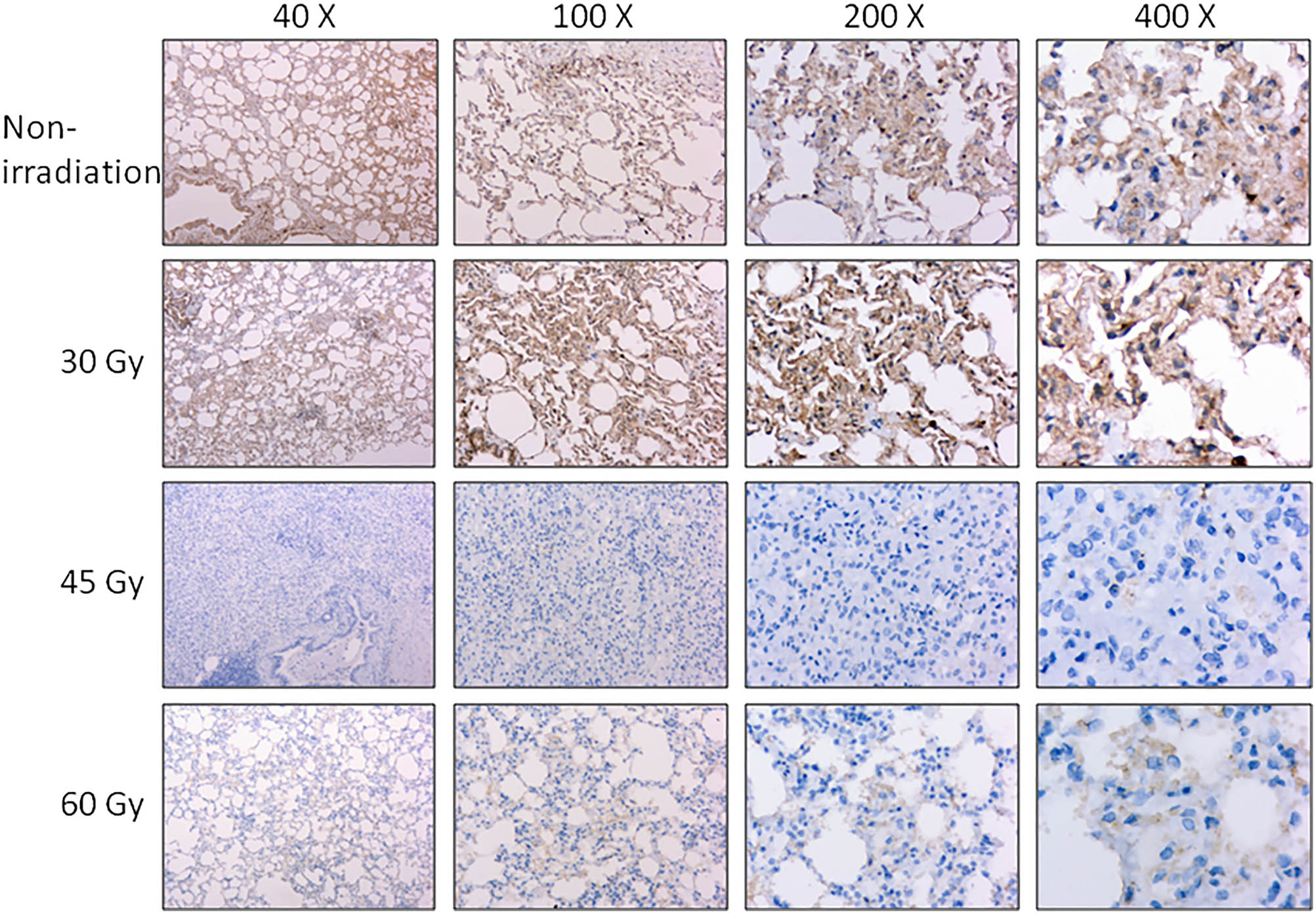 Figure 4 
                  Effects of irradiation on the expression of BAX. The protein level of BAX was detected by using immunohistochemistry under a magnification of 40×, 100×, 200×, and 400×, respectively.
               
