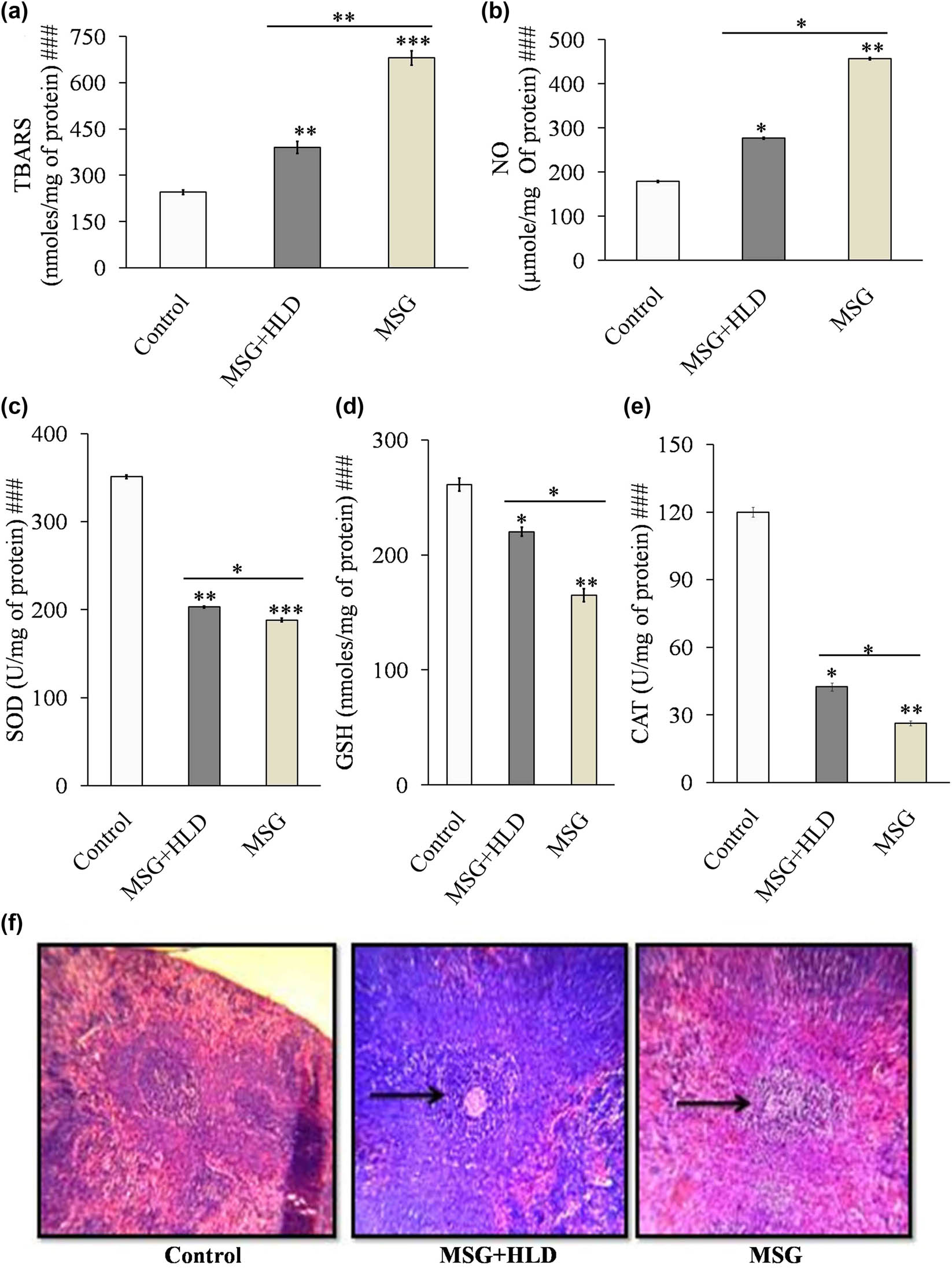Figure 4 
                  MSG with or without HLD induced changes in lipid peroxidation (a), NO (b), SOD (c), GSH (d), CAT (e), and spleen tissue architecture (f). Black pointed arrows indicate the degree of injury in spleen tissue by MSG or MSG + HLD. Significance level based on Kruskal–Wallis test [###P < 0.001]. Control vs MSG and Control vs MSG + HLD: ***P < 0.001, **P < 0.01 and *P < 0.05.
               