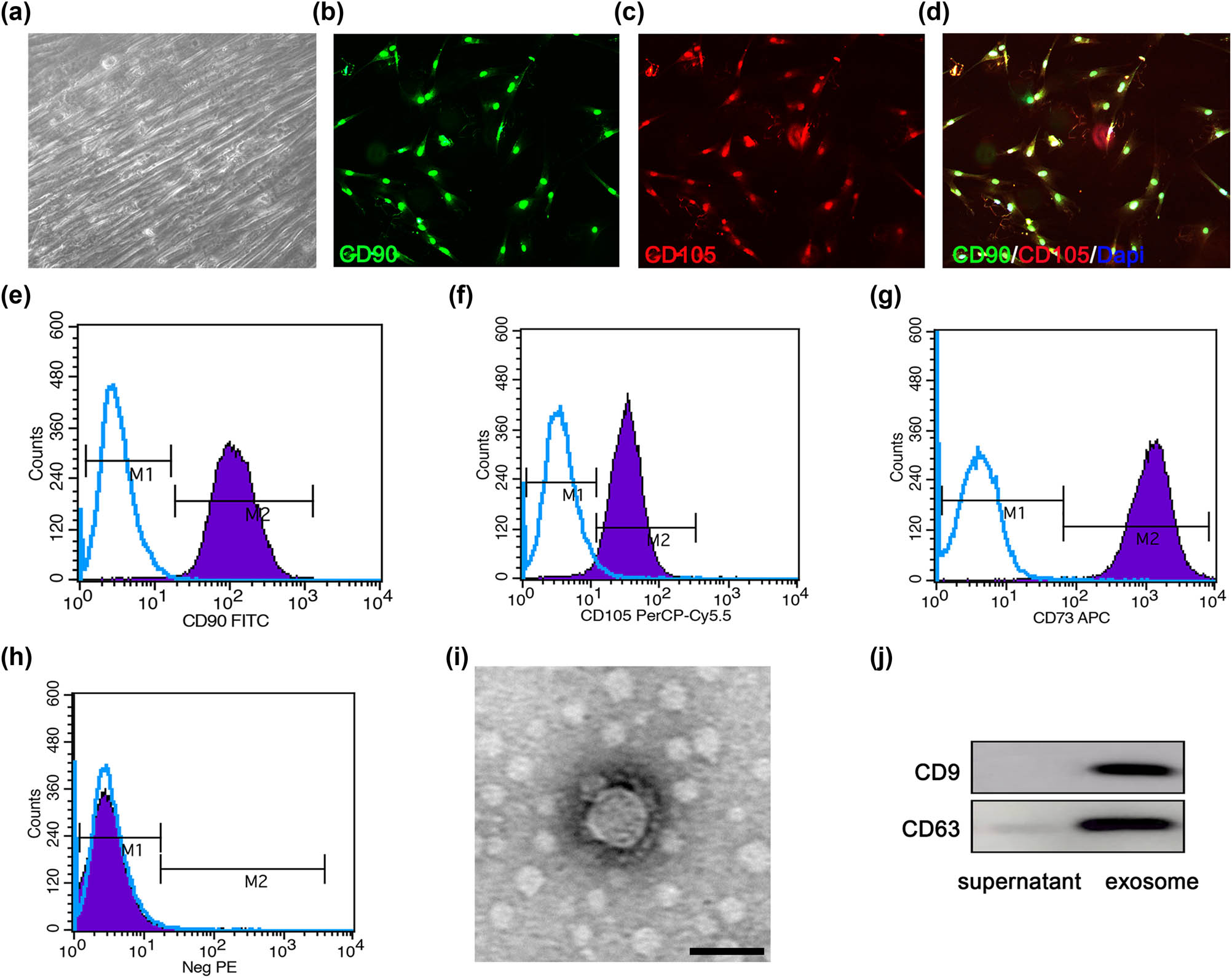 Figure 1
Identification of HUCMSCs and the HUCMSCs-derived exosomes. (a) Representative cell morphology of 4th generation HUCMSCs in phase contrast microscopy. (b–d) Double immunostaining with an anti-CD90 antibody (green) and an anti-CD105 antibody (red) to identify HUCMSCs. (e–h) Expression of CD90 (e), CD105 (f), CD73 (g), and negative molecules (Neg PE) (CD45, CD116, CD19, and HLA-DR) (h) on HUCMSCs detected by flow cytometry. (i) Representative transmission electron microscope image of the exosomes. (j) Exosomes surface marker protein expression of exosomes by Western blot. Scale bars = 50 µm in panels (a–d), 100 nm in panel (i).