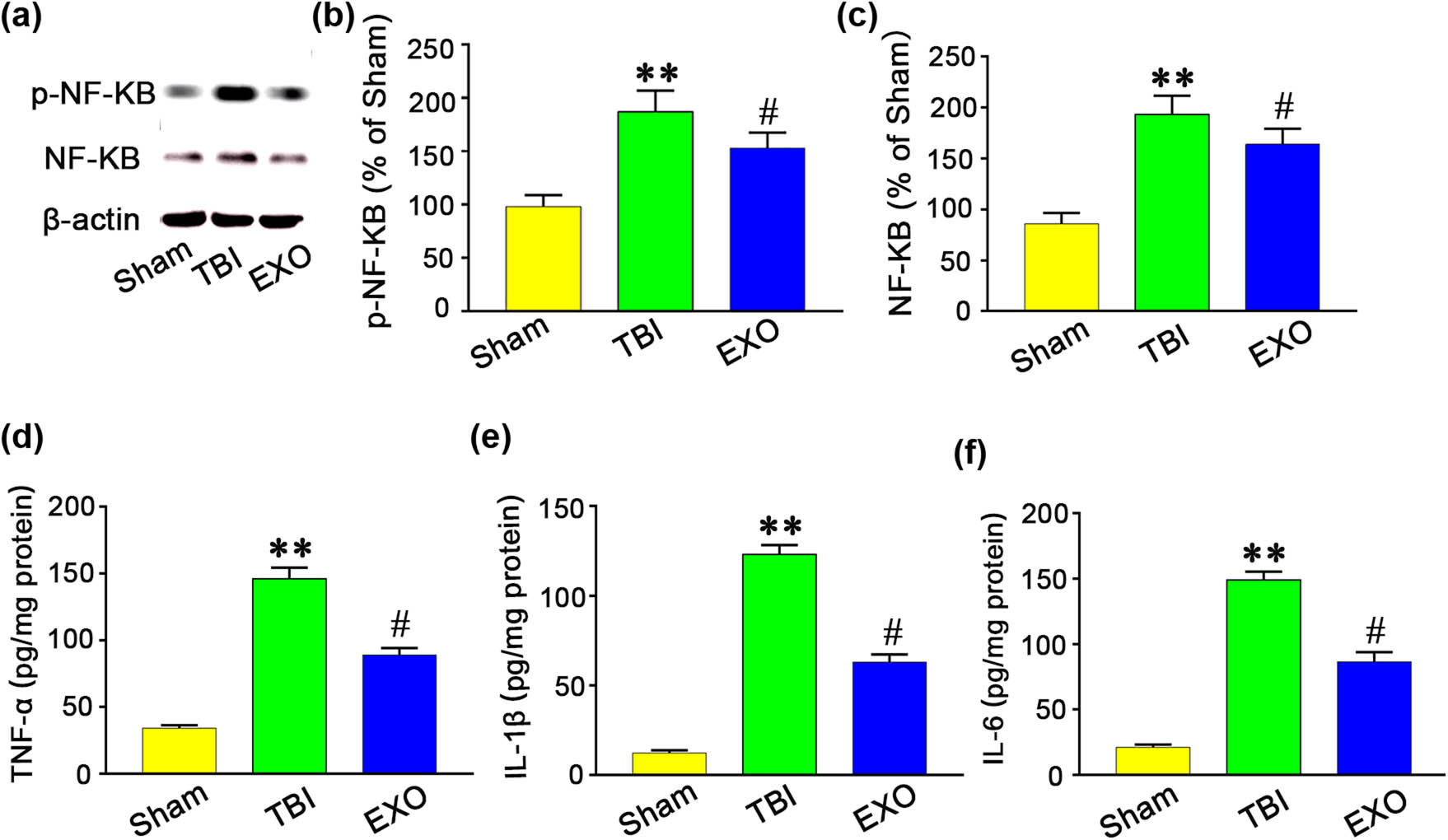 Figure 3
Administration of the HUCMSCs-derived exosomes reduced p-NF-κB and NF-κB and inflammatory cytokines (TNF-α, IL-1β, and IL-6) expression at 3 days after TBI. (a) Rats treated with HUMSCs-exo showed a decrease in NF-κB and p-NF-κB expression. (b and c) Western blotting showed that exosomes reduced p-NF-κB and NF-κB levels in the cortex. (d–f) TBI induced TNF-α, IL-1β, and IL-6 increase in rats. Rats treated with HUMSCs-exo showed a decrease in TNF-α, IL-1β, and IL-6 level. ELISA showed that HUMSCs-exo treatment reduced TNF-α, IL-1β, and IL-6 protein levels. **P < 0.01 vs Sham group. #
P < 0.05 vs TBI group.