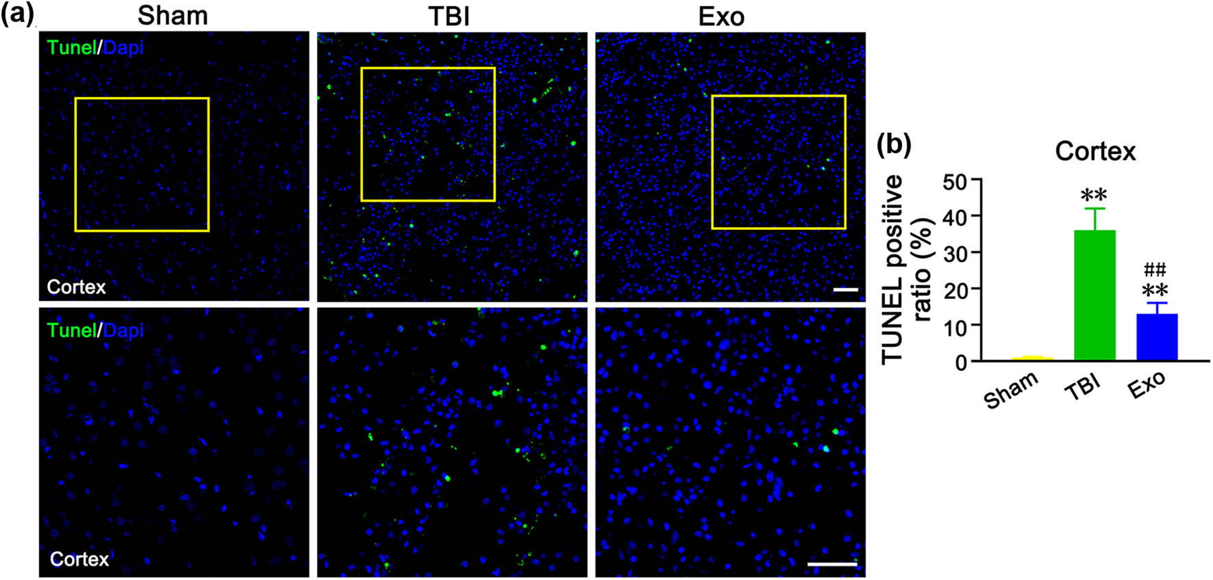 Figure 4
Administration of the HUCMSCs-derived exosomes attenuated neuronal apoptosis in the injured cortex of rats at 3 days after TBI. (a) TUNEL staining in the cortex in three groups. The image below is an amplified image of the yellow box in the image above. (b) Percentage of TUNEL positive rate in the injured cortex. **P < 0.01 vs Sham group. ##
P < 0.01 vs TBI group. Scale bars = 50 µm in (a).