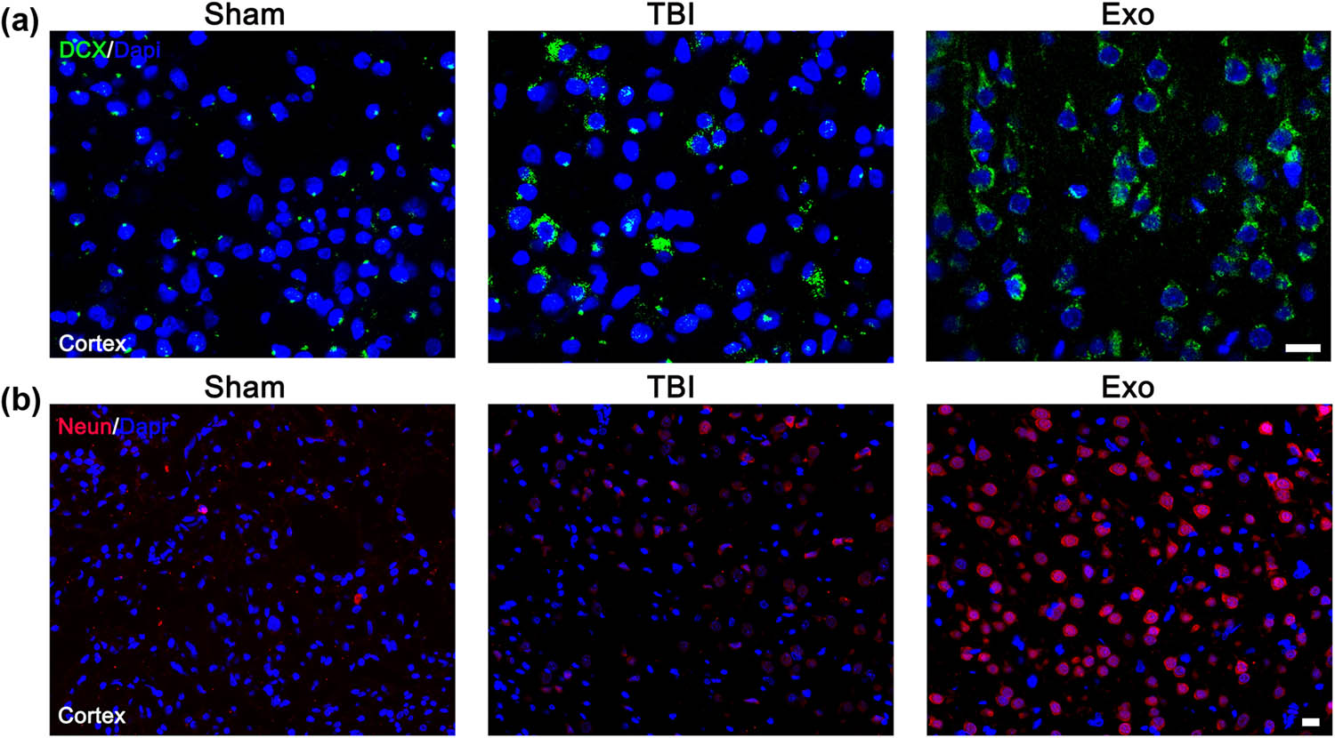 Figure 6
Administration of the HUCMSCs-derived exosomes obviously facilitated neuron regeneration in the injured cortex of rats after TBI. (a) DCX-positive cells in the injured cortex of three groups at 7 days after TBI. (b) NeuN-positive cells in the injured cortex of three groups at 28 days after TBI. Scale bars = 50 µm in panels (a and b).