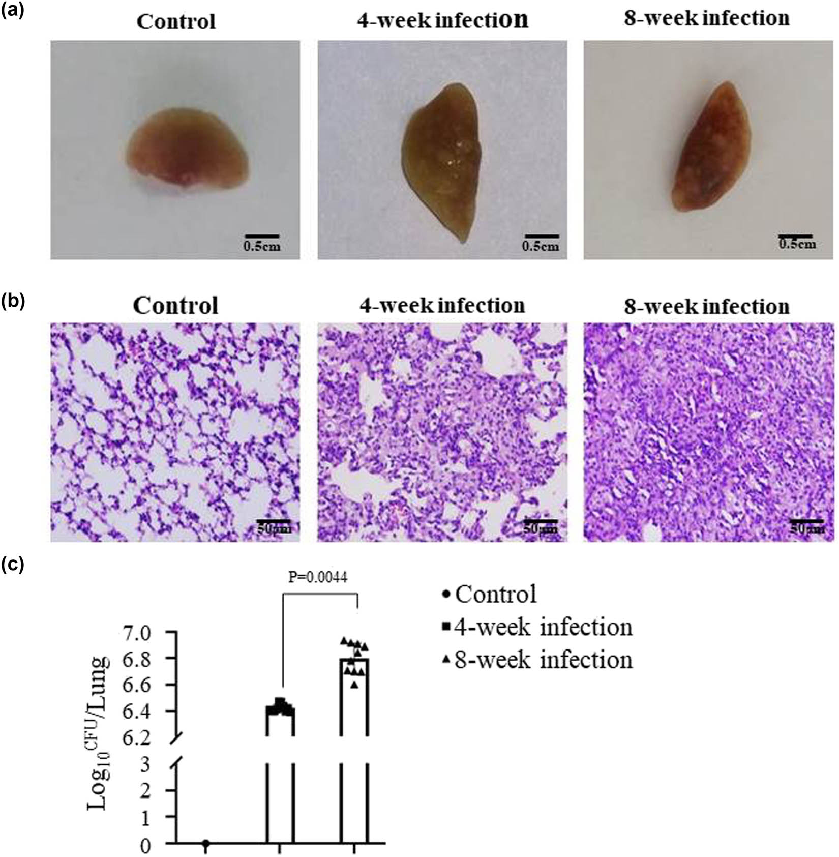Figure 2
Mtb infection causes lung pathological change in mice. (a) The images of lung tissues fixed with 10% formalin at 4 or 8 weeks after the Mtb challenge the mice were killed. The control lung tissue (left), at 4 week Mtb-infected lung tissue (middle), and at 8 week Mtb-infected lung tissue (right). (b) The sections of the control alveolar architecture (left), the lung injury at 4 week post-infection (middle), and the lung injury at 8 week post-infection (right), which were stained with HE and observed under microscope (×200). (c) The statistical analysis of total numbers of CFUs in the different mouse groups. The histogram represents a set of data for 10 mice, referring to the differences as shown.