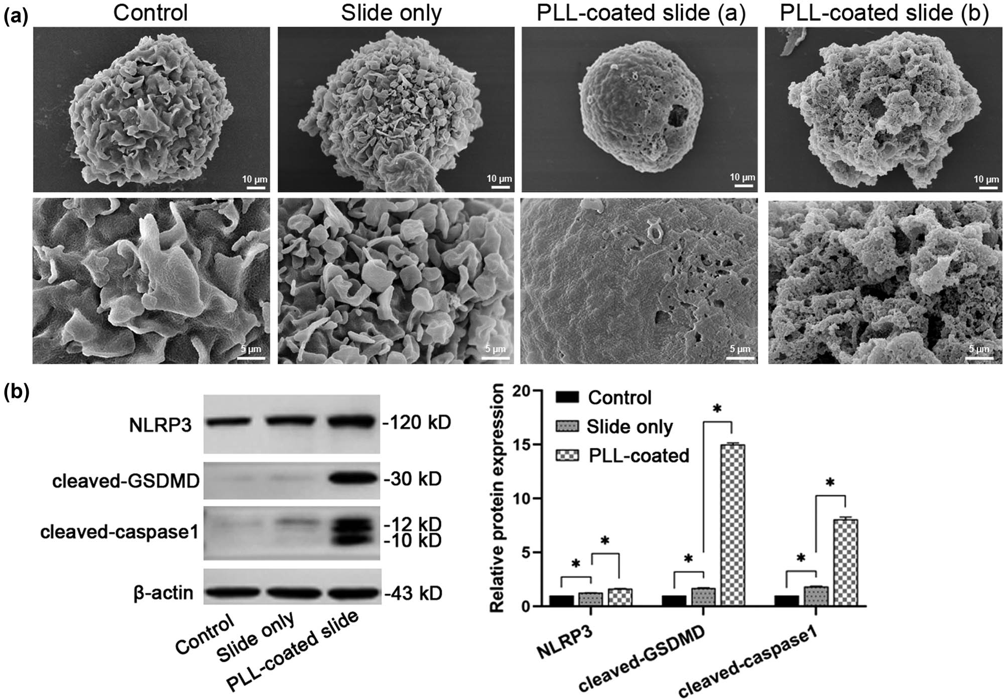 Figure 1
PLL-caused cell adhesion induced pyroptosis in THP-1 monocytes. (a) Morphology of THP-1 cells. SEM images of the cells in the control, slide only, and PLL-coated slide groups (from left to right). Upper scale bar: 10 μm; lower scale bar: 5 μm. (b) Western blotting images and quantification of indicated pyroptotic proteins (NLRP3, cleaved-GSDMD, and cleaved-caspase 1) in THP-1 cells in different groups. *P < 0.05; N = 3.