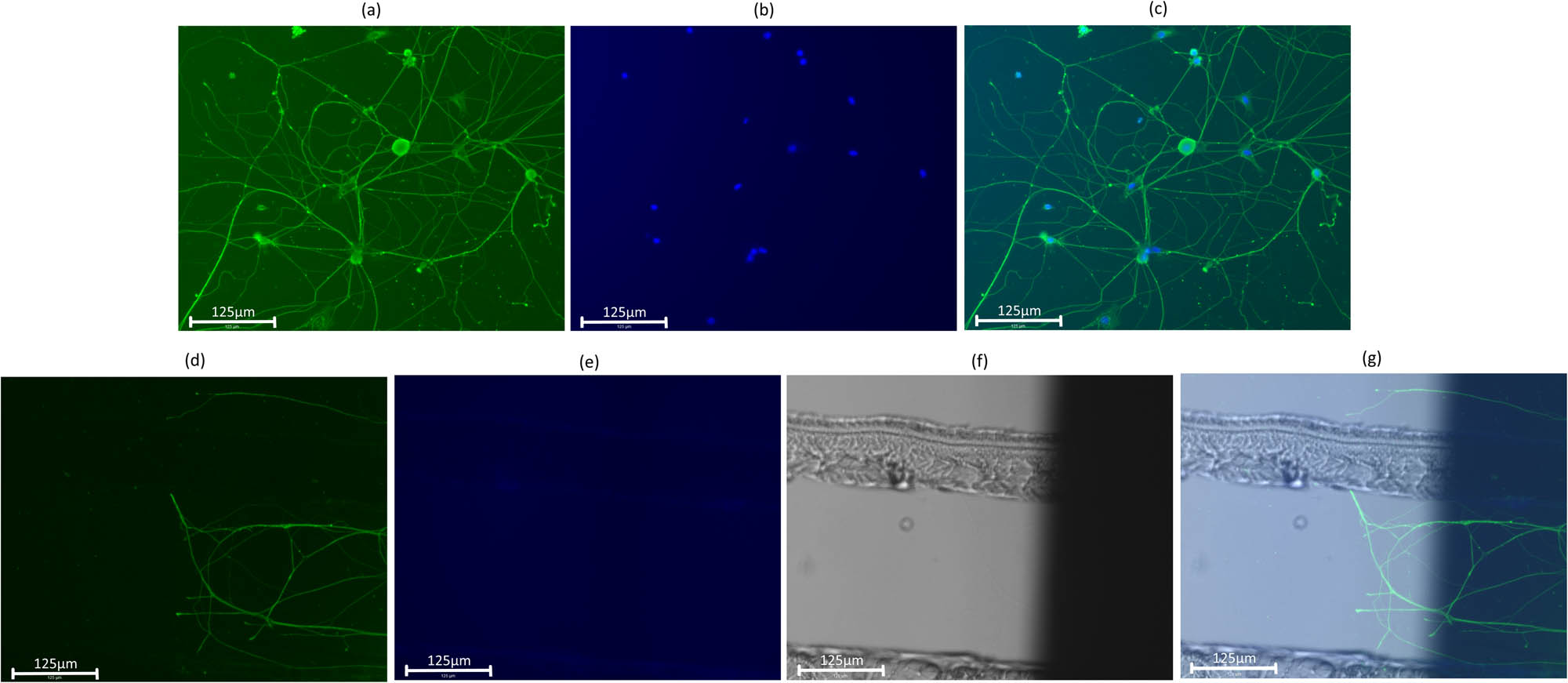 Figure 5
Merged image. The size of the scale bar is 125 μm. Axons are immunostained with anti-beta tubulin with GFP and observed at a wavelength of 482 nm (a). Cell bodies are immunostained with DAPI and observed at a wavelength of 390 nm (b). These images are merged for observation (c). When axon extension was observed, the three images for GFP, DAPI, and the ordinal microscope view were merged (d–g).