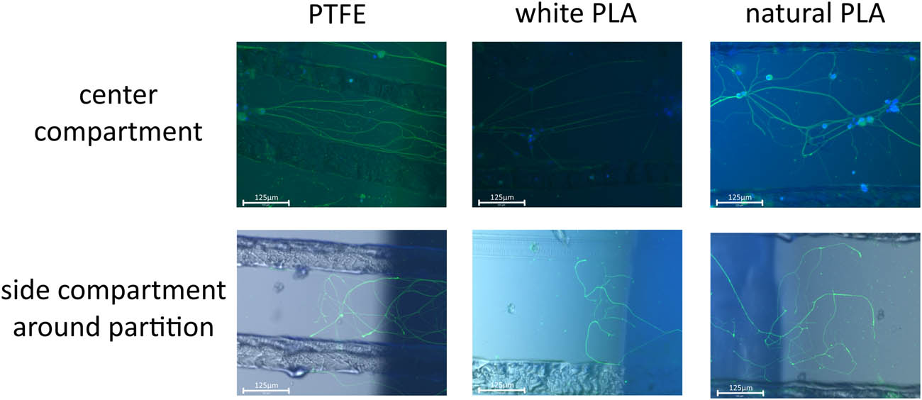 Figure 7
Cultured neurons for each group. The pictures are for cultured neurons and the size of the scale bar is 125 μm. On day 7, beta-tubulin was immunostained to observe the axon, and the cell body was stained by DAPI. Beta-tubulin was observed with GFP. The upper row is lined with images of the center compartment, which are merged with GFP and DAPI. The lower row is lined with images of the side compartment around the partition between the center and side compartments, which are merged with GFP, DAPI, and ordinal microscope view. The columns represent PTFE, white PLA, and natural PLA in that order.