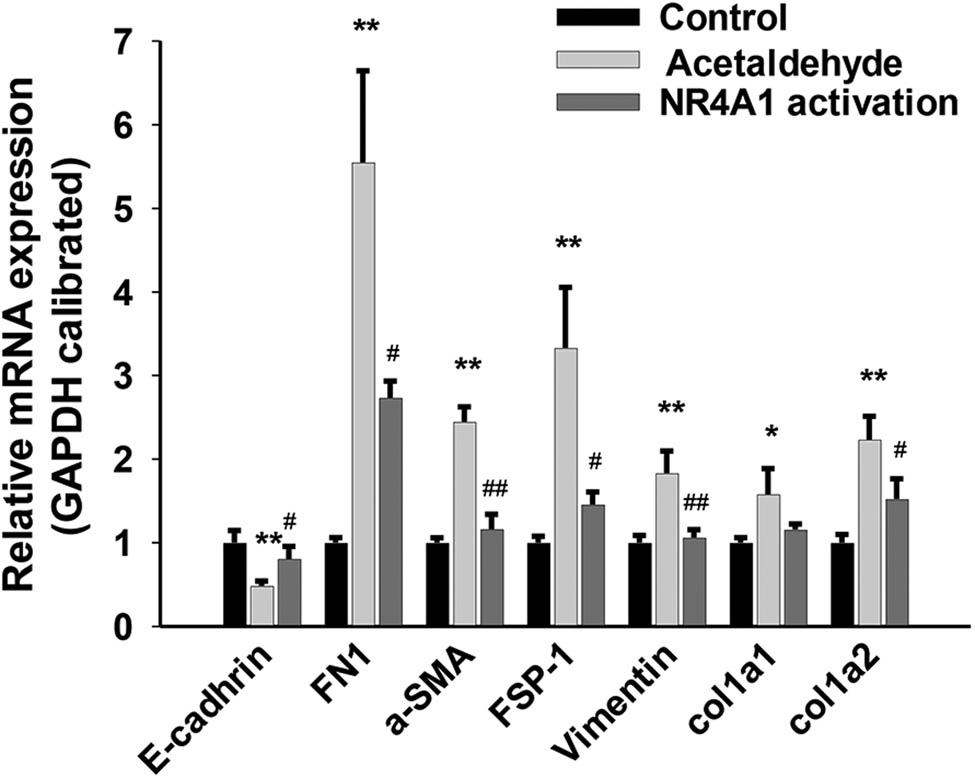 Figure 1
Effects of NR4A1 on EMT-related genes in HSC-T6 cells. The mRNA levels of E-cadherin in the acetaldehyde group were significantly downregulated, whereas FN, FSP-1, vimentin, α-SMA, and COL1A1/COL1A2 were significantly upregulated. The mRNA levels of E-cadherin in the NR4A1 activation group were significantly upregulated, while FN, FSP-1, vimentin, α-SMA, and COL1A1/COL1A2 were significantly downregulated. The mRNAs were analyzed by qRT-PCR analysis. *P < 0.05, **P < 0.01 vs control, #
P < 0.05, ##
P < 0.01 vs acetaldehyde. n = 3/group.