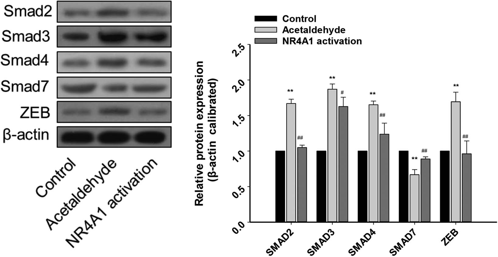 Figure 3
Effects of NR4A1 on the protein levels of Smad2/3/4, Smad 7, and ZEB. Protein levels of Smad2/3/4 and ZEB in the acetaldehyde group were upregulated, while that of Smad 7 was downregulated. The expression of these proteins was reversed in the NR4A1 activation group. The proteins were analyzed by western blotting. β-Actin was used as an internal control. *P < 0.05, **P < 0.01 vs control, #
P < 0.05, ##
P < 0.01 vs acetaldehyde. n = 3/group.