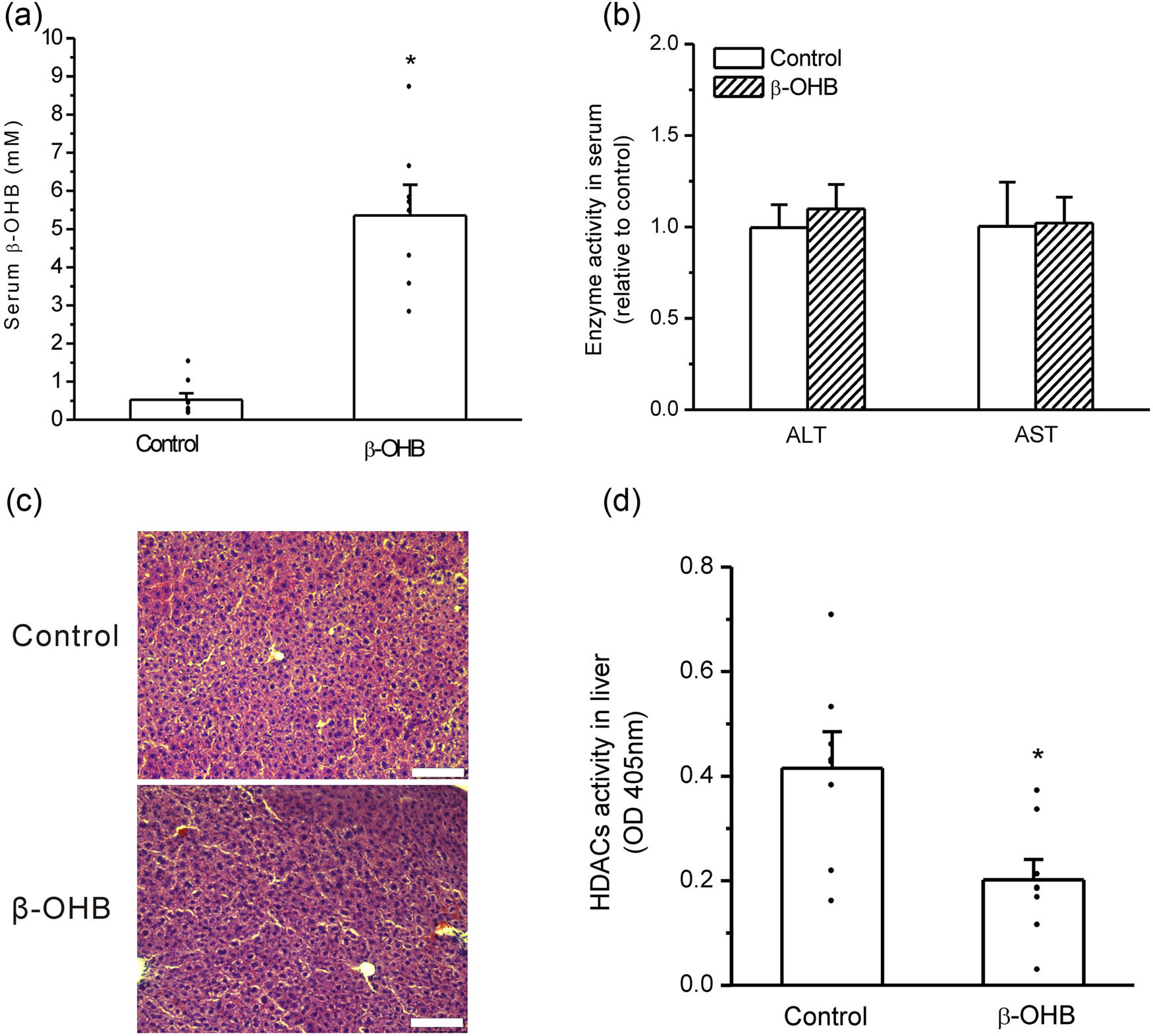 Figure 4
Acute increase in serum β-OHB inhibited HDACs’ activity in mouse liver. (a) β-OHB injections resulted in significant elevation of serum β-OHB (*P < 0.05 vs control, n = 8 mice per group); (b) β-OHB injections had no significant influence on ALT and AST activities in mouse serum (no significance vs control, n = 8 mice per group); (c) β-OHB injections had no significant influence on hepatic tissue structure (bar means 100 μm); and (d) β-OHB injections significantly inhibited HDACs’ activity in mouse liver (*P < 0.05 vs control, n = 8 mice per group).