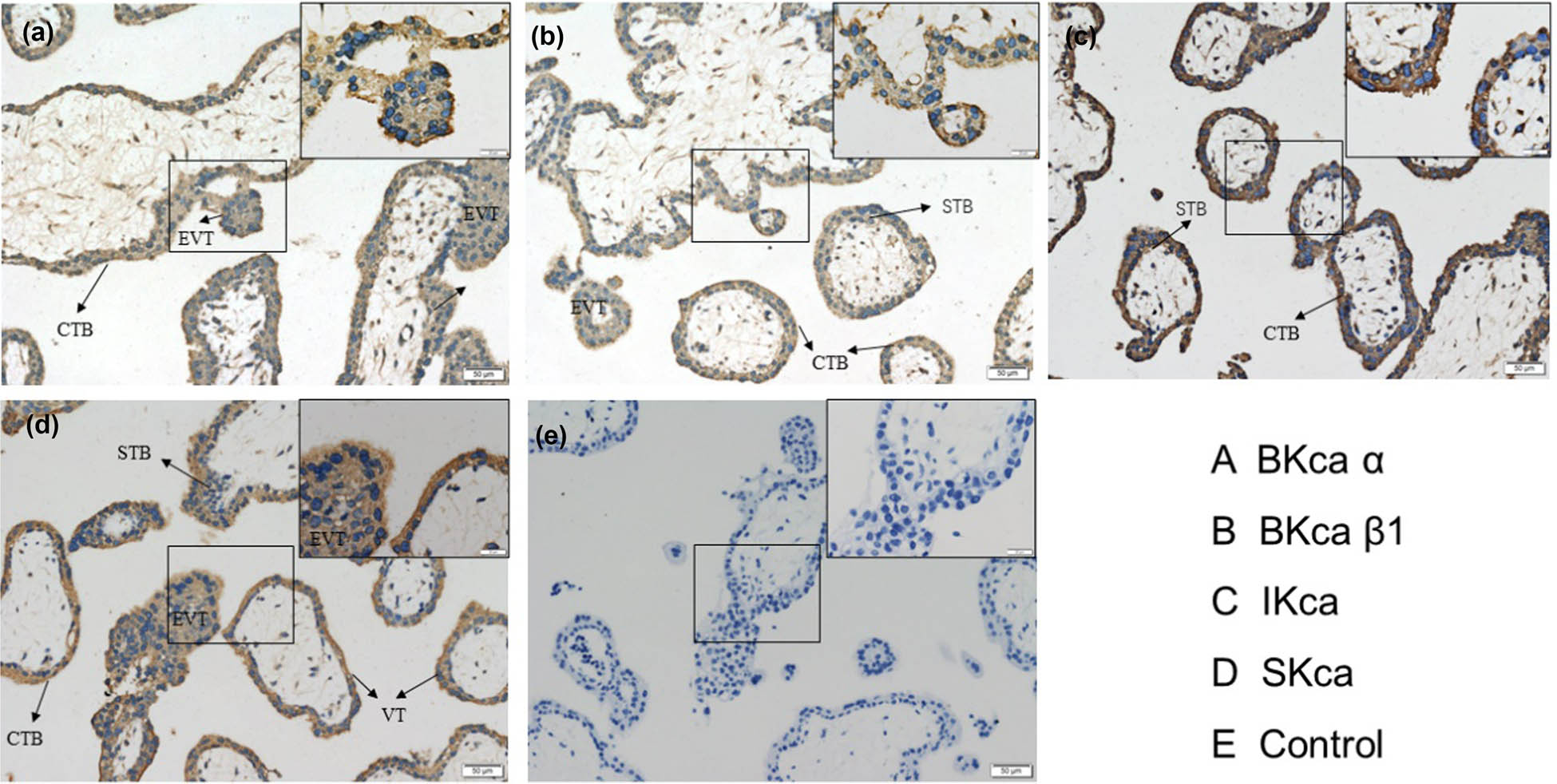Figure 1
Expression of KCa channels in human villus tissues. Immunohistochemical detection of different types of KCa channels (BKCa α, BKCa β1, IKCa, and SKCa) and the negative control in human villus tissues.