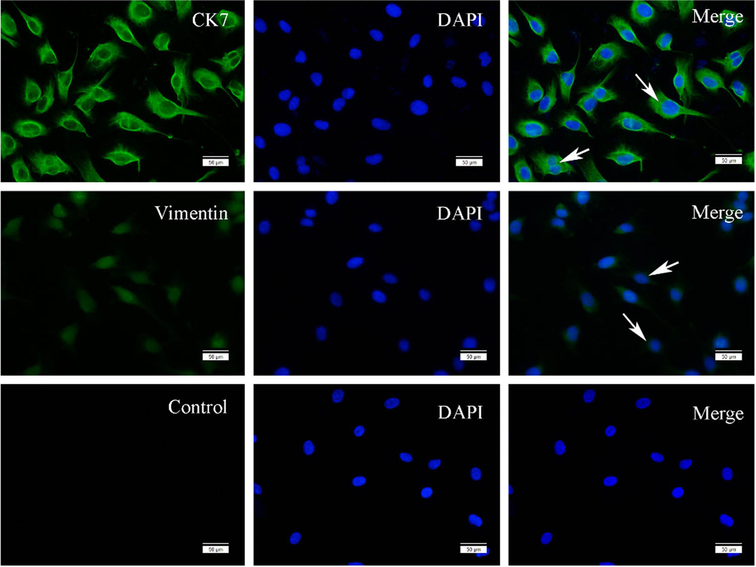 Figure 2
Localization and expression of CK7 and vimentin in HTR-8/SVneo cell line. CK7 and vimentin localization were detected by immunostaining with anti-CK 7 and anti-vimentin (green) under the fluorescence microscope, respectively. Cells were stained with DAPI to visualize nuclei (blue). Arrow indicates the positive staining.