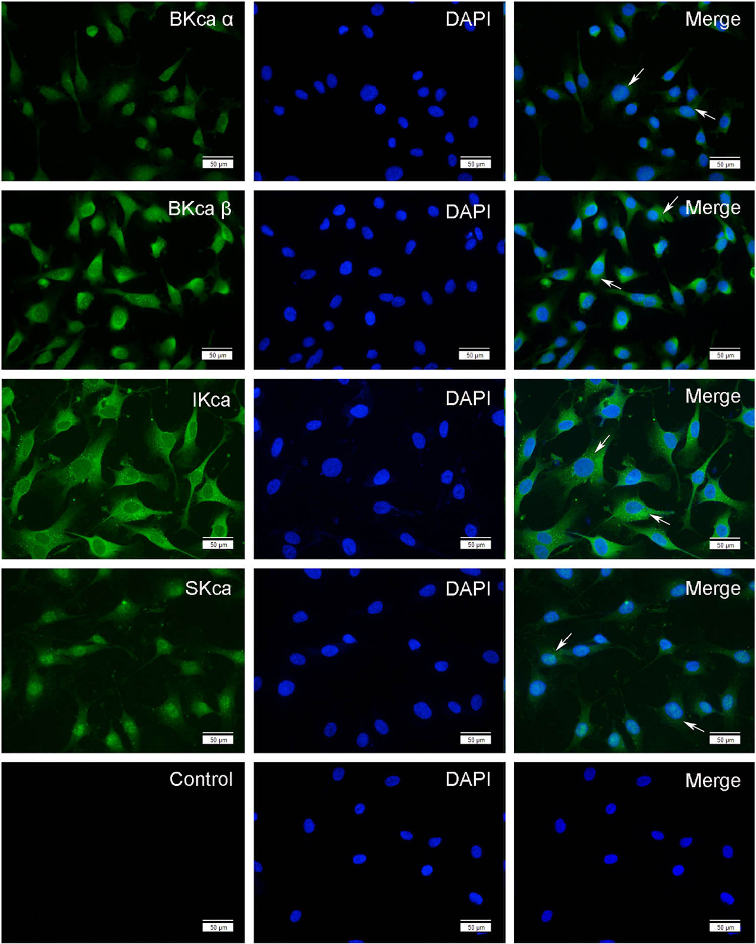 Figure 3
Localization and expression of KCa channels in HTR-8/SVneo cells. BKCa α and β1 subunits, IKCa channels, SKCa channels, and the control in HTR-8/SVneo cells were observed under the fluorescence microscope. Cells were stained with DAPI to visualize nucleus (blue) and immunolabeled with Anti-KCa antibodies (green), respectively. Arrow indicates the positive staining.