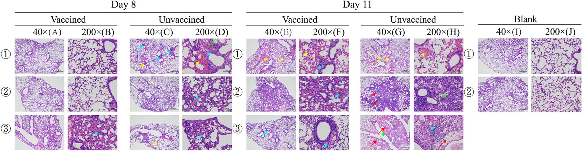 Figure 8
On day 8 PC, few lung lesions in the mice were discovered in the vaccine group, and there were no significant abnormalities in tissues (1A/1B/2A/2B). The alveolar wall was slightly thickened, along with a small amount of granulocyte infiltration (blue arrow) (3A/3B). Significant lesions appeared in the lungs of mice in the placebo group, and it was more common for lymphocytes to show focal infiltration around the blood vessels (blue arrow). Inflammatory cell infiltration was noted in a small number of alveolar cavities (green arrow). Due to local bleeding, red blood cells are visible in the alveolar cavity (yellow arrow) (1C/1D). The alveolar wall was slightly thickened, along with a small amount of granulocyte infiltration (blue arrow) (2C/2D). It was more common that congestion was seen in the blood vessels (yellow arrow). The alveolar wall was slightly thickened, along with a small amount of granulocyte infiltration (blue arrow) (3C/3D). On day 11 PC, lesions also developed in the lungs of mice in the vaccine group. There were multiple congestion sites in blood vessels and alveolar wall capillaries (yellow arrow). Few perivascular lymphocytes showed focal infiltration (blue arrow) (1E/1F). A large area of the alveolar wall was moderately thickened with a small amount of granulocyte infiltration (blue arrow) (2E/2F). Few perivascular lymphocytes showed small focal infiltrates (blue arrow) (3E/3F). However, more severe lesions were observed on day 11 PC in the placebo group, with multiple congested sites in the blood vessels and alveolar wall capillaries (yellow arrow). There were perivascular edema and loose connective tissue, accompanied by a small amount of lymphocyte infiltration (purple arrow) (1G/1H). A large area of alveolar wall was severely thickened, with a small amount of granulocyte infiltration (blue arrow). Inflammatory cells showed diffuse infiltration in multiple alveolar cavities (green arrow). It was more common that perivascular lymphocytes showed focal infiltration (purple arrow) (2G/2H). There was a large area of tissue necrosis (red arrow), with structural disorder. It was more common that eosinophilic homogenates appeared in the alveolar cavities (green arrow), surrounded and accompanied by a small amount of inflammatory cell infiltration. Inflammatory cell infiltration was seen in multiple alveolar cavities (blue arrow). There were perivascular edema and loose connective tissue, with a small amount of lymphocyte infiltration (purple arrow) (3G/3H). No significant abnormalities were found in the lung tissue of mice in the blank group (1I/1J/2I/2J).