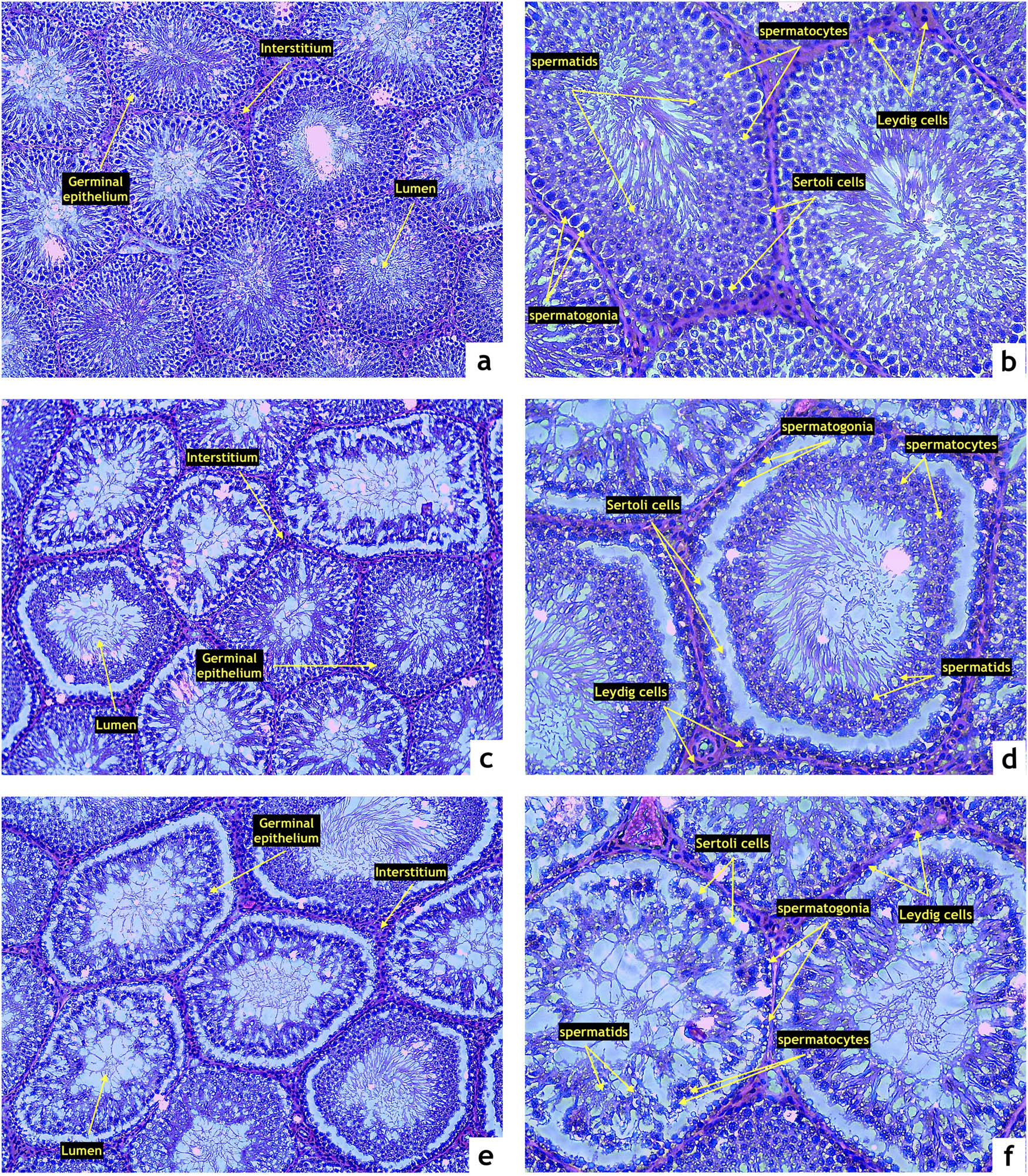 Figure 2
Representative photomicrographs of testicular structure comprising the seminiferous epithelium (SE), lumen (L), and interstitium (IS) stained by hematoxylin and eosin. (a and b) Control (n = 15); (c and d) ZDF nonobese (n = 15), and (e and f) ZDF obese rats (n = 16). Light microscopy; primary magnification 10× (a, c, and e) and 20× (b, d, and f).