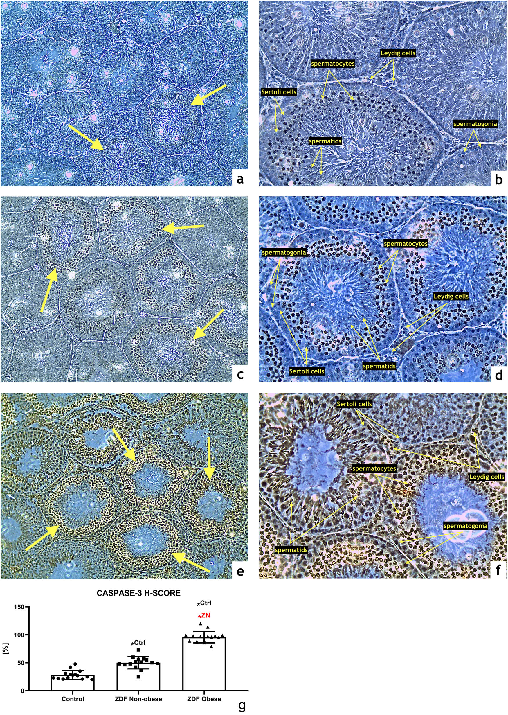 Figure 3
Representative photomicrographs of caspase-3-positive germinal cells of seminiferous tubules in the (a and b) control (n = 15); (c and d) ZDF nonobese (n = 15) and (e and f) ZDF obese rats (n = 16). Light microscopy; primary magnification 10× (a, c, and e) and 20× (b, d, and f). (g) H-SCORE evaluation of the immunocytochemical reaction. Mean ± SD. Significant (*) if P < 0.05. Ctrl – versus control; ZN – versus ZDF nonobese.