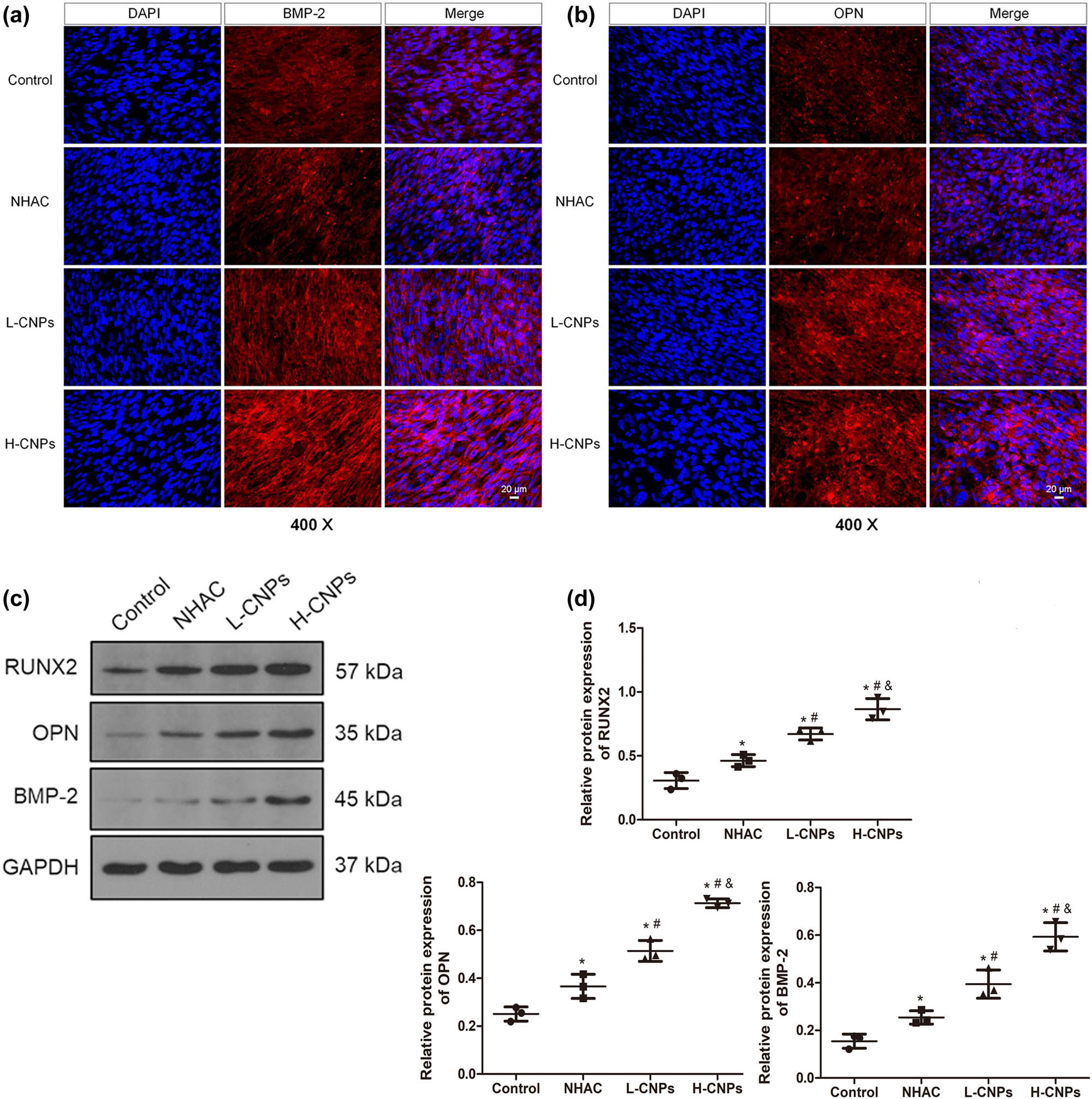 Figure 2
Effects of CNPs on calcification-related proteins, including BMP-2, OPN, and RUNX2 in MSCs after 6 days of co-culture. (a) BMP-2 protein expression was determined using immunofluorescence assays. (b) OPN protein expression was measured using immunofluorescence assays. (c) Protein bands of BMP-2, OPN, and RUNX2 were visualized by western blotting. (d) The gray values of BMP-2, OPN, and RUNX2 were quantified using ImageJ software. *P < 0.05, compared to the control group; #
P < 0.05, compared to the NHAC group; and P < 0.05, compared to the L-CNP group.