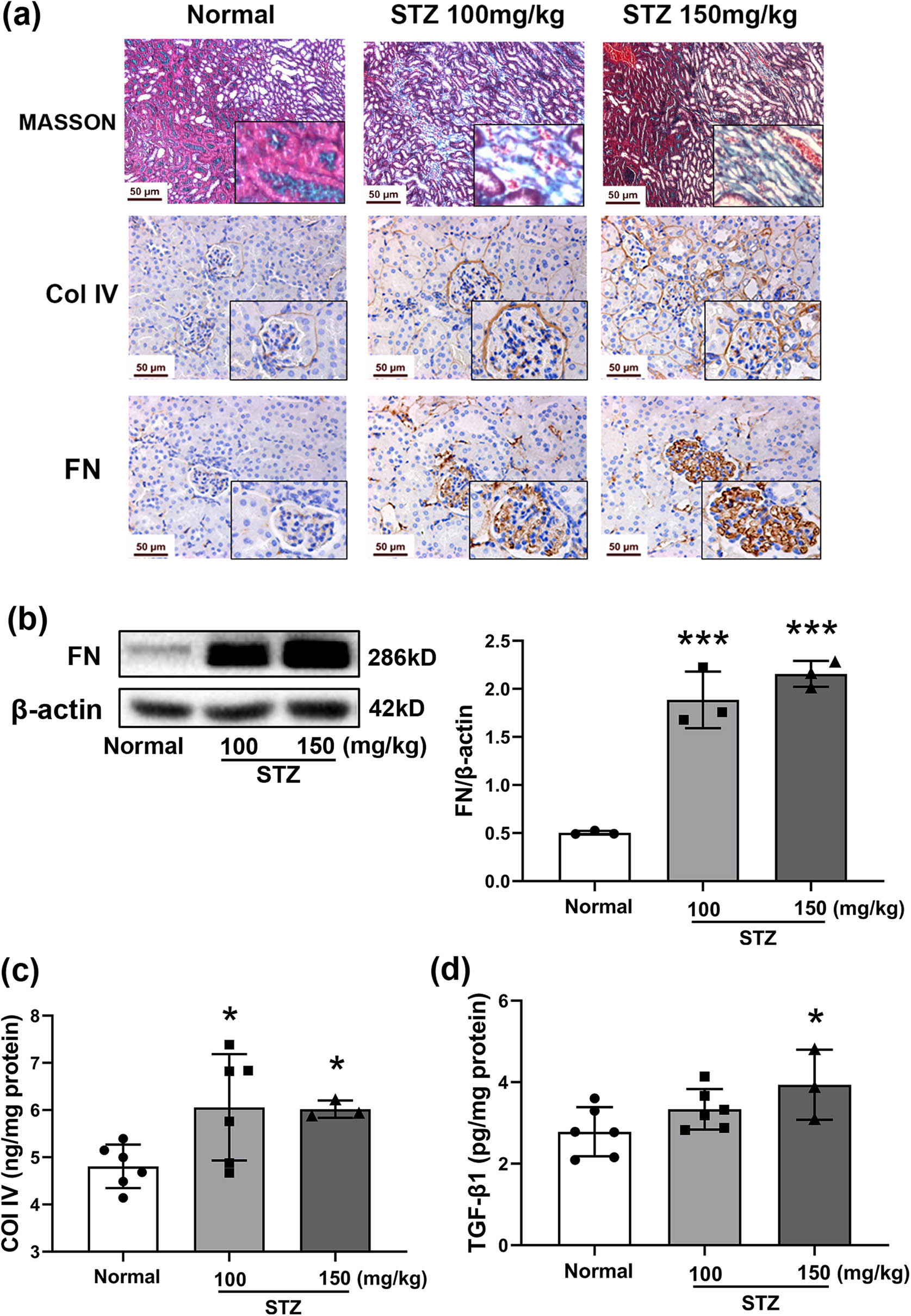 Figure 3
Severity of renal fibrosis in STZ-induced diabetic mice. Mice were treated with STZ at 100 or 150 mg/kg by intraperitoneal injection. The kidney was dissected on Day 64. Histological assays of the kidney (Masson’s trichome), immunohistochemical staining of Col IV and FN in the kidney (a), photographed at 400× magnification. Protein expression of FN in the kidney by Western blot (b), n = 3. β-Actin was used as an internal control. The levels of Col IV (c) and TGF-β1 (d) in renal tissues tested by ELISA. Data are expressed as the mean ± SD. *P < 0.05, ***P < 0.001 vs the normal group, tested by one-way ANOVA and Fisher’s PLSD.